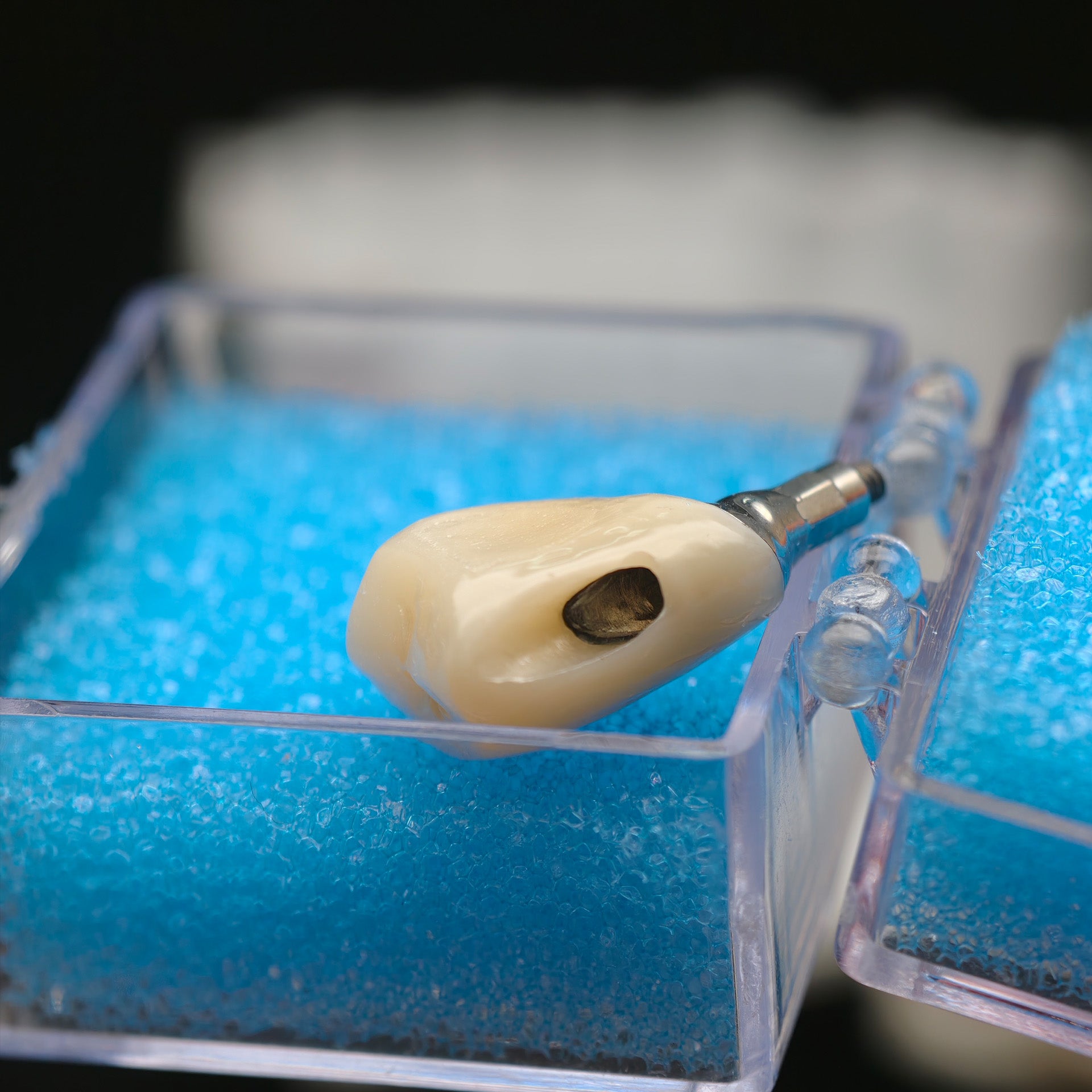 Custom Zirconia Implant Crown