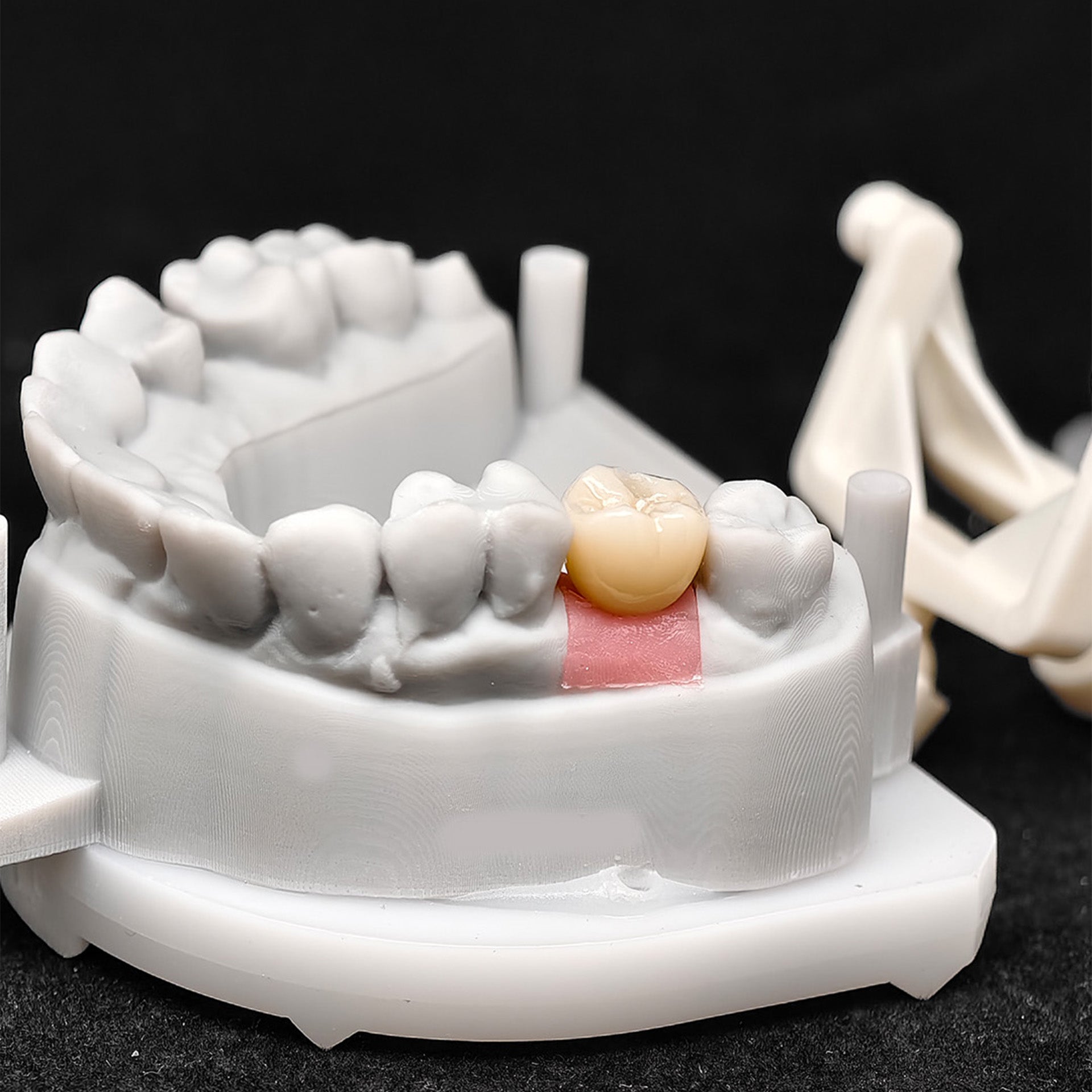 Custom Zirconia Implant Crown