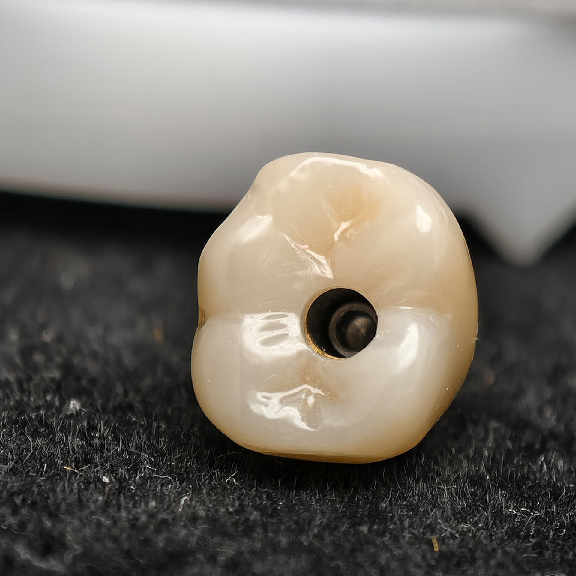 Custom Zirconia Implant Crown