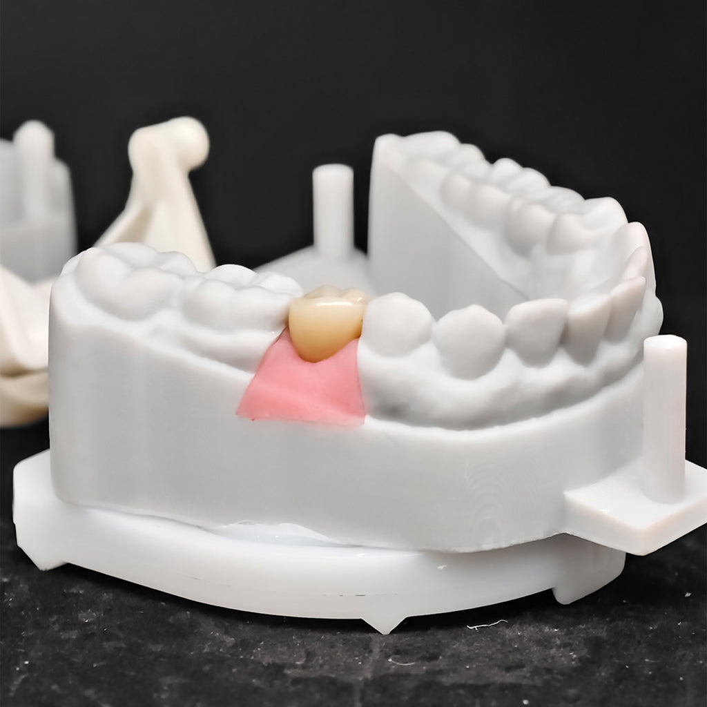 Custom Zirconia Implant Crown