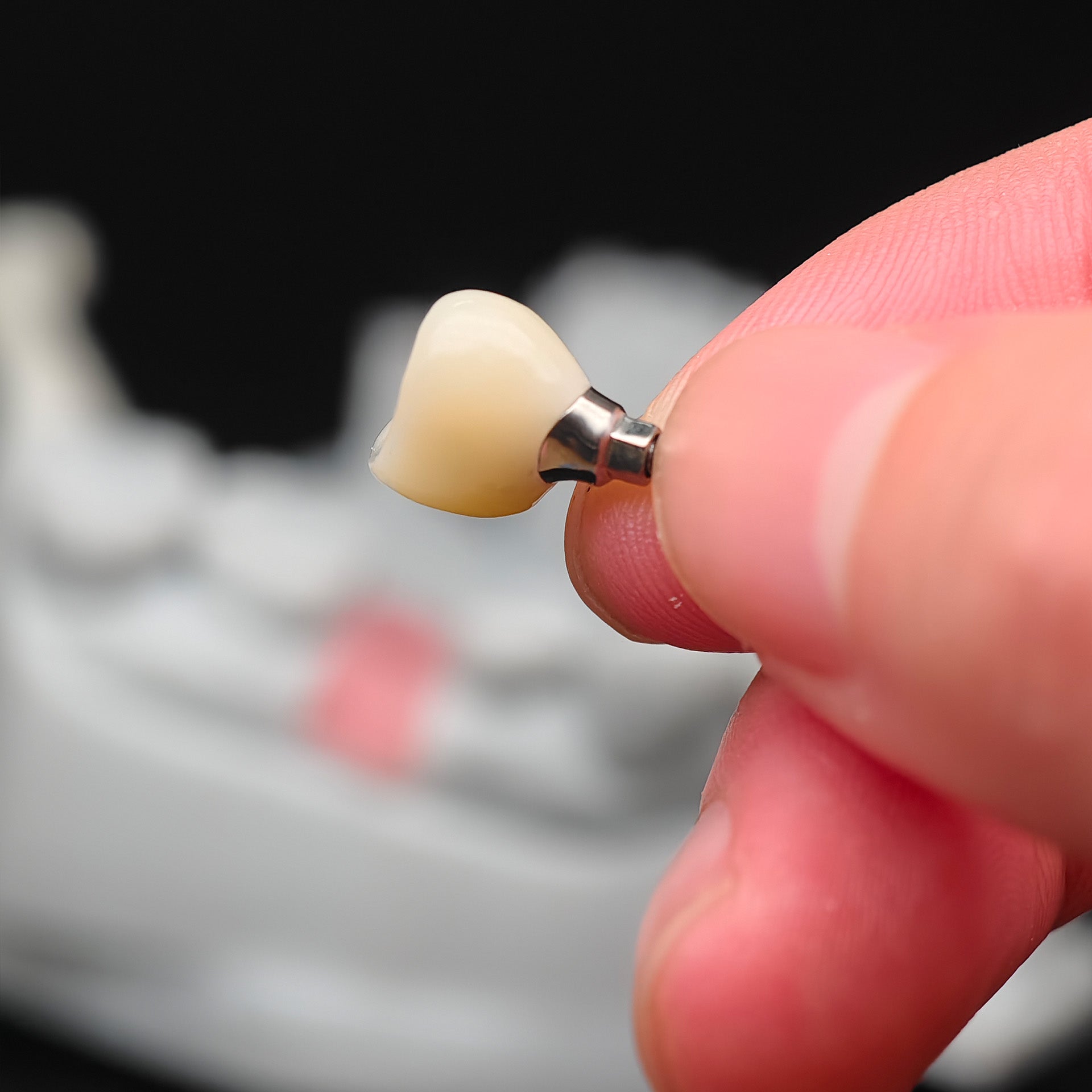 Custom Zirconia Implant Crowns