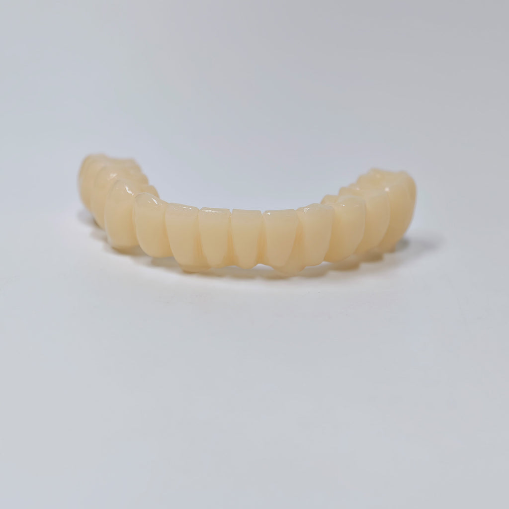 Custom Abutment And PMMA Bridge With Cement Retained And Implant Seating Guide