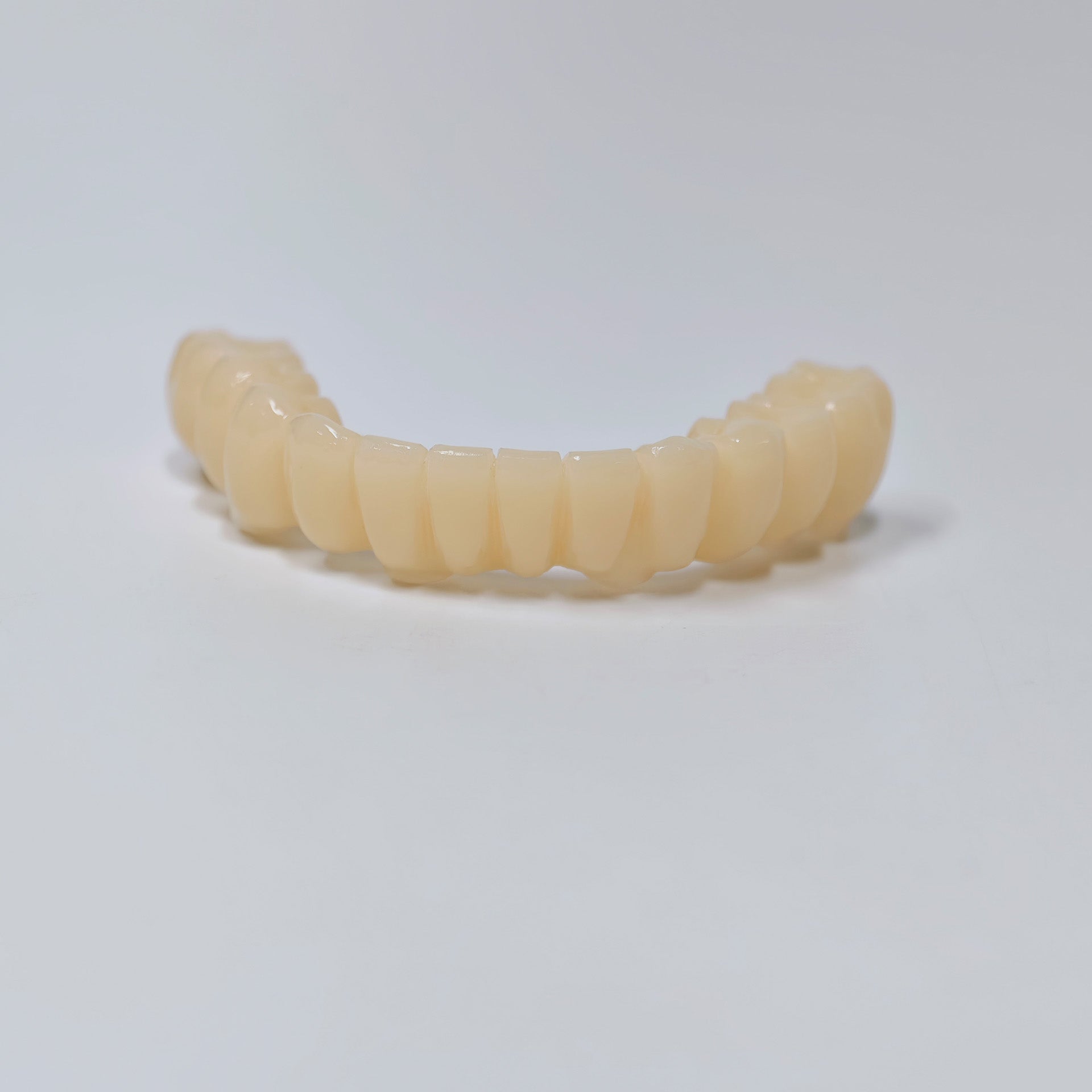 Custom Abutment And PMMA Bridge With Cement Retained And Implant Seating Guide