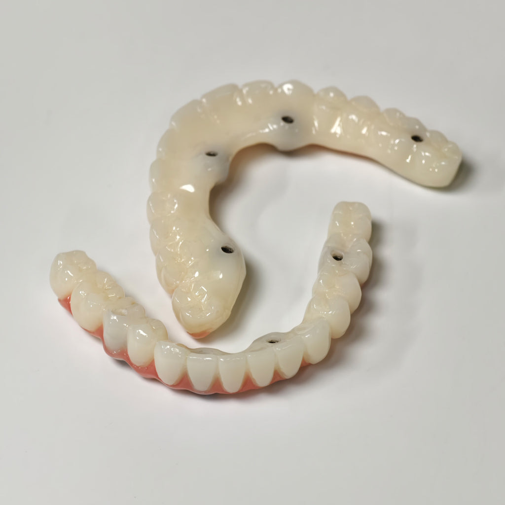 Full-Arch PMMA Bridge With Ti-Base Screw Retained