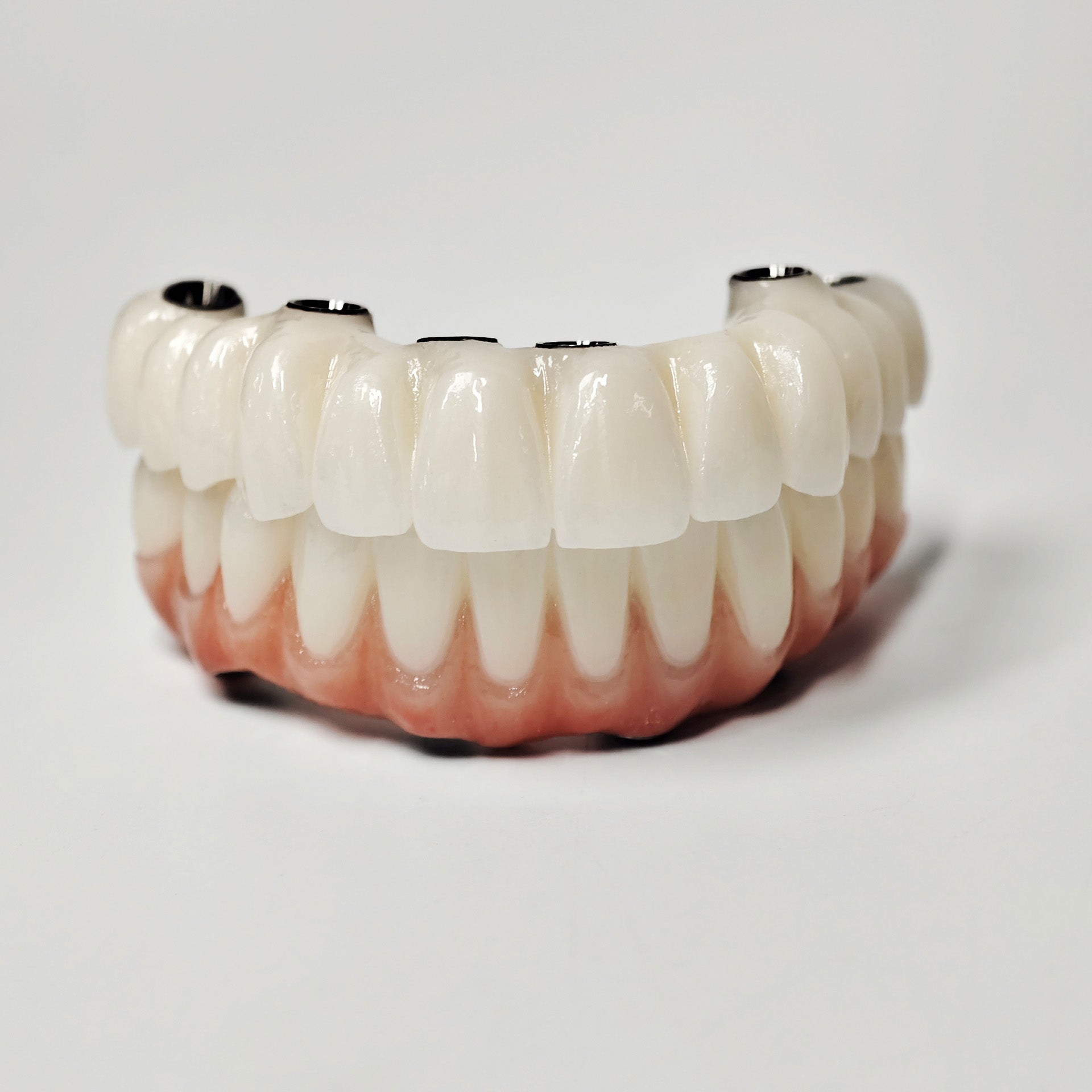 Full-Arch Zirconia Bridge With Ti-Base Abutment