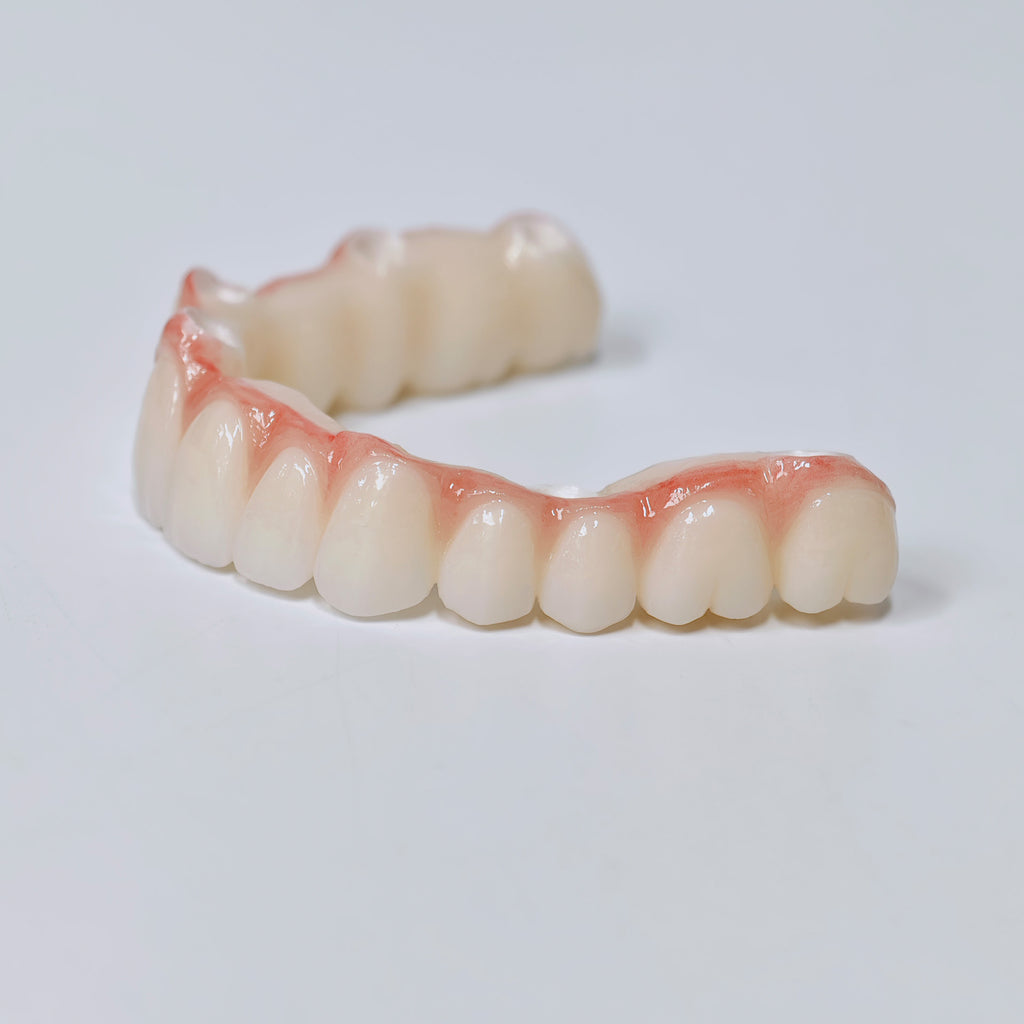 Half-Mouth Zirconia Bridge With Cement-Retained