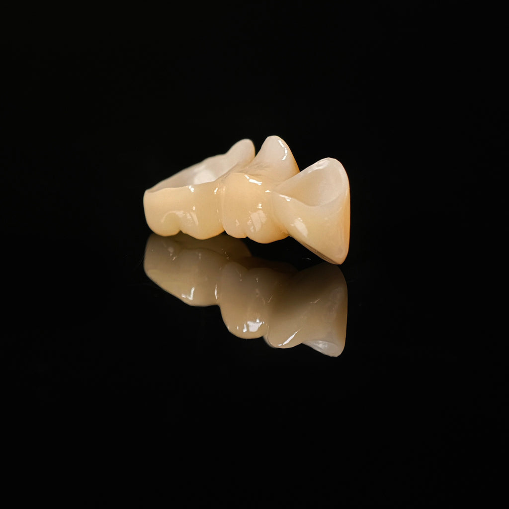 High - Strength Zirconia Bridge