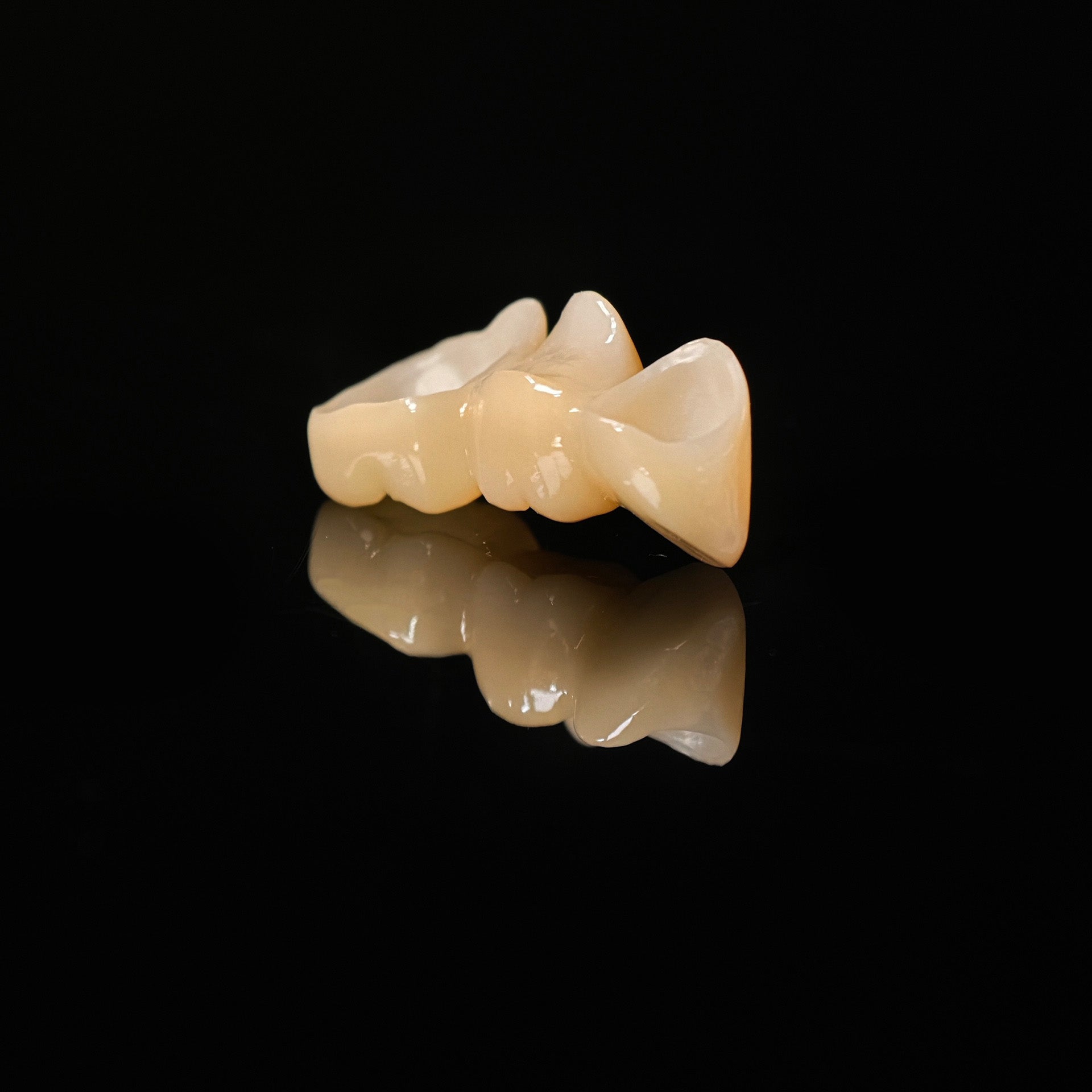 High - Strength Zirconia Bridge