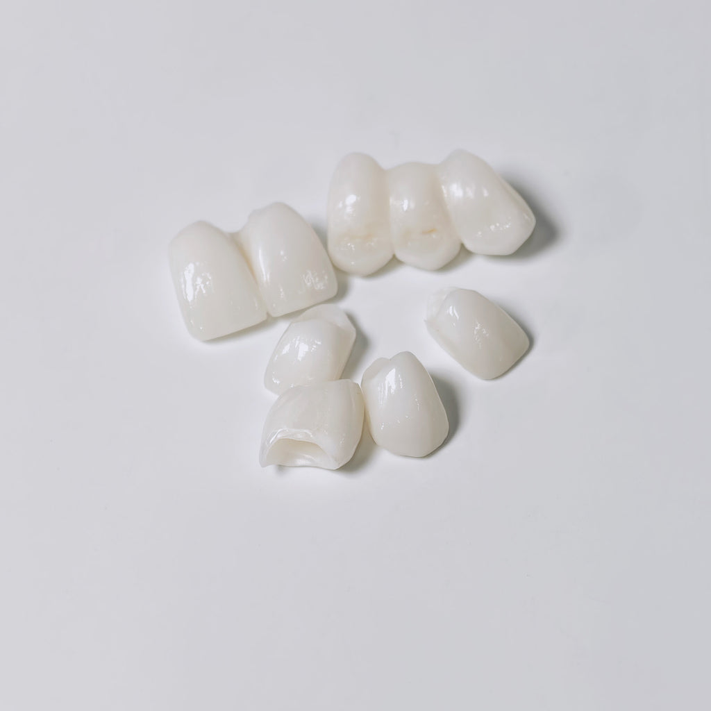 High - Strength Zirconia Bridge Aesthetic