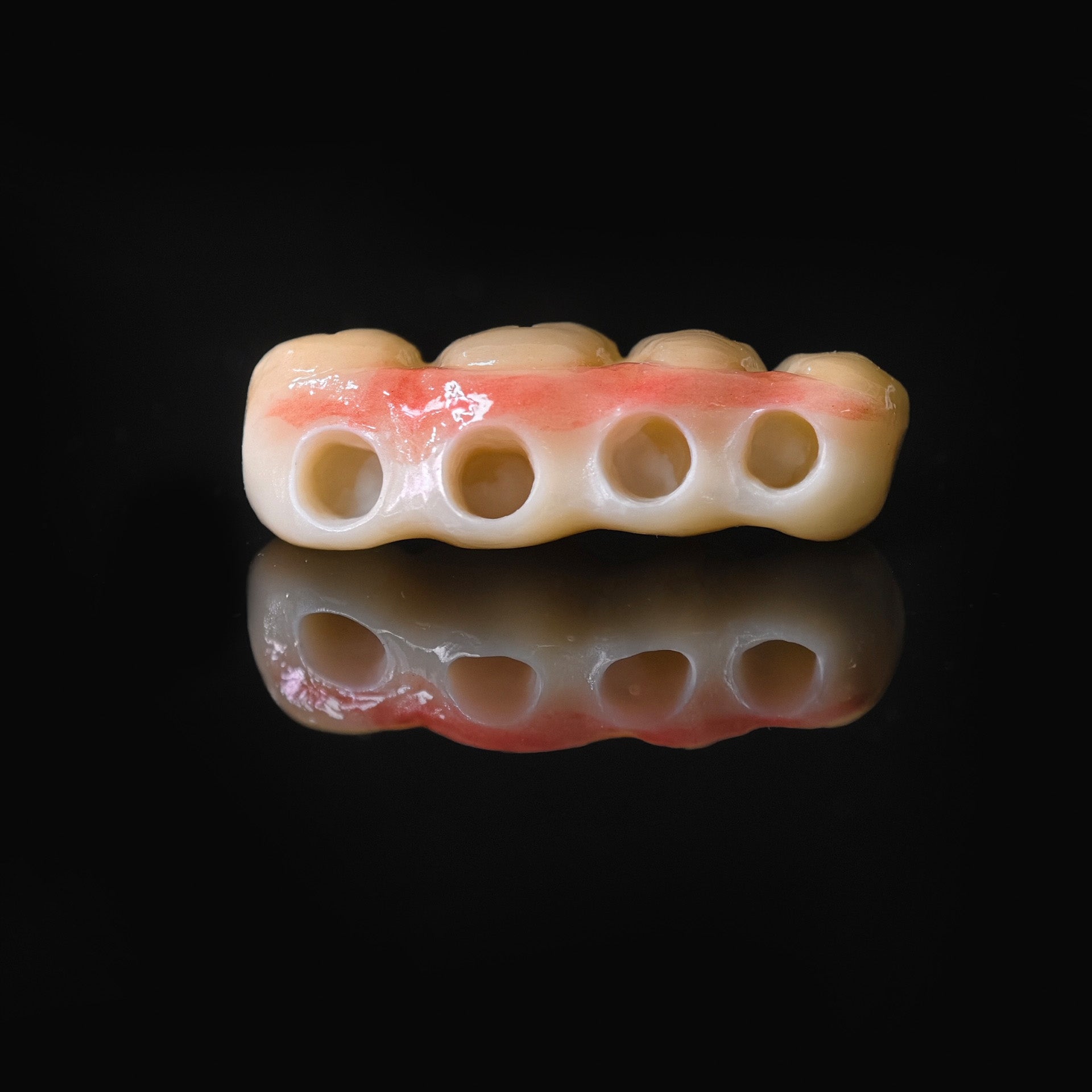 High - Strength Zirconia Bridge