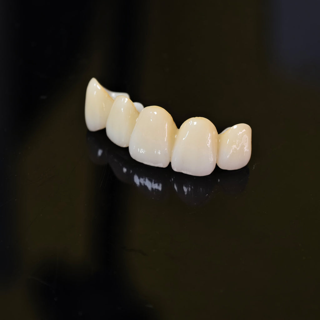 High - Strength Zirconia Bridge