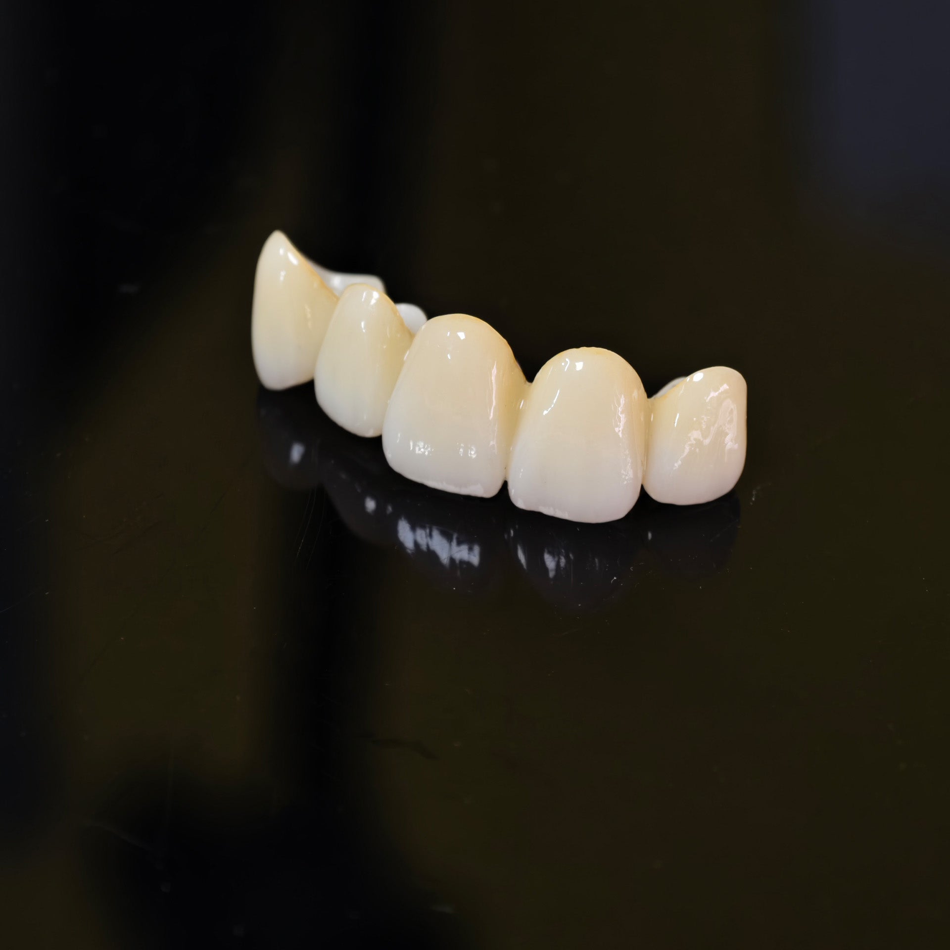 High - Strength Zirconia Bridge