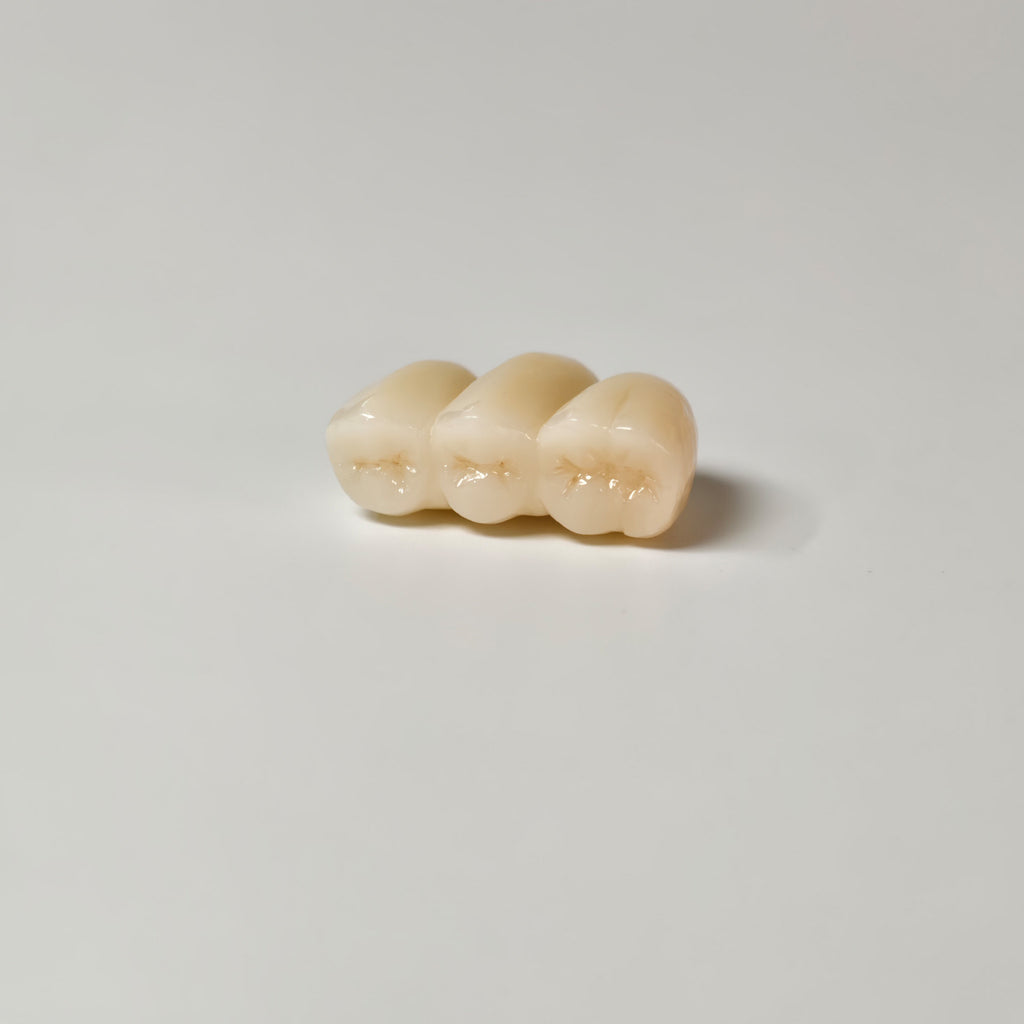 High - Strength Zirconia Bridge