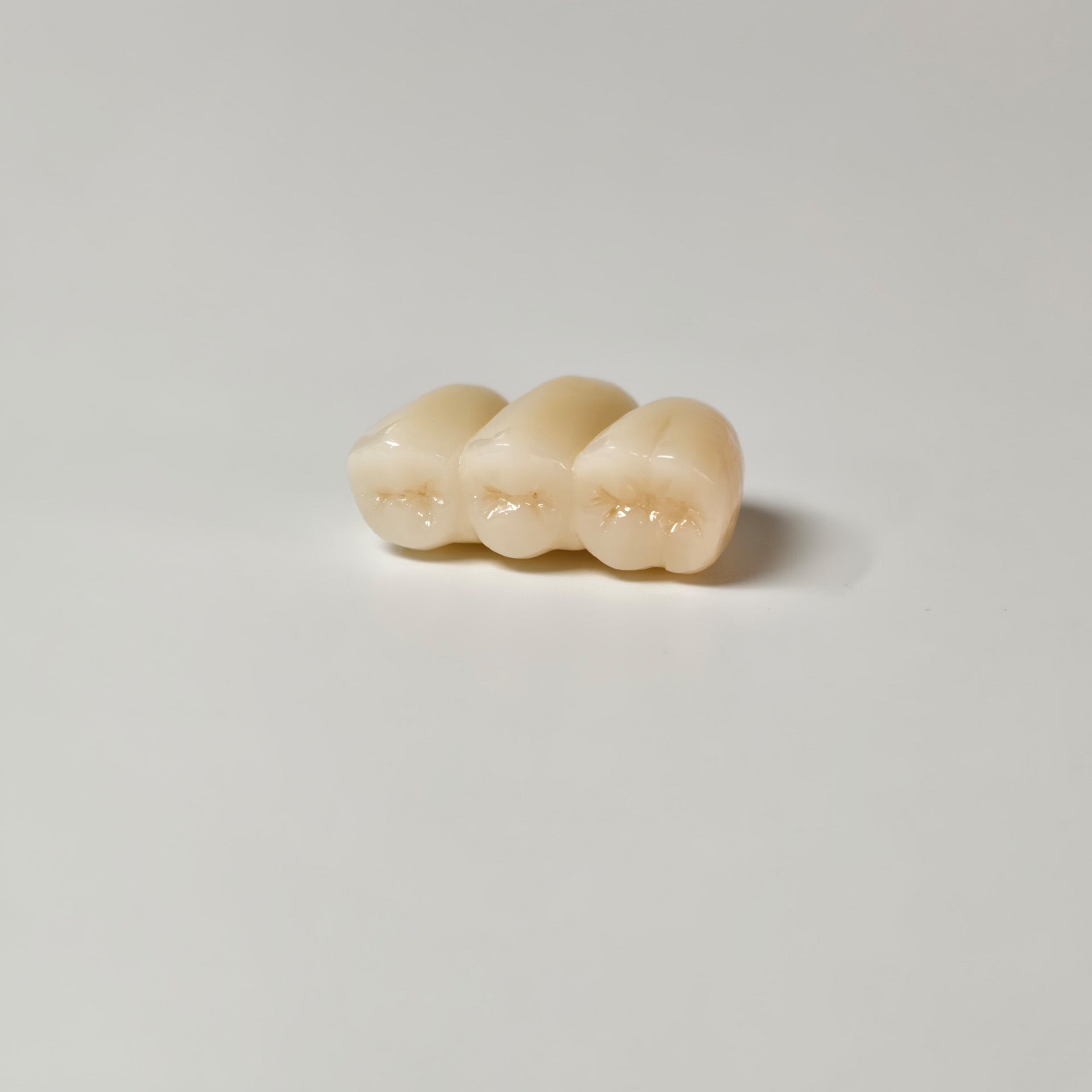 High - Strength Zirconia Bridge