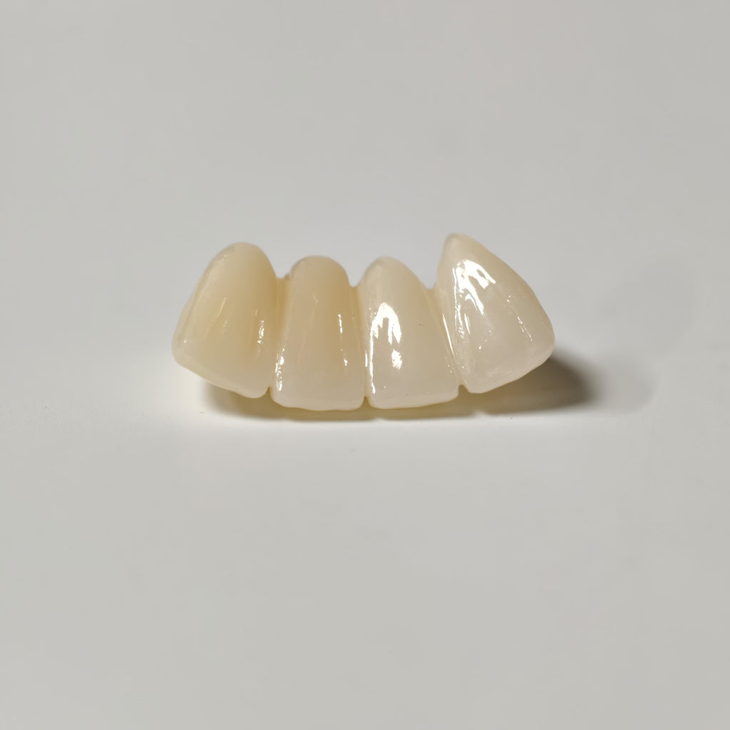 High - Strength Zirconia Bridge