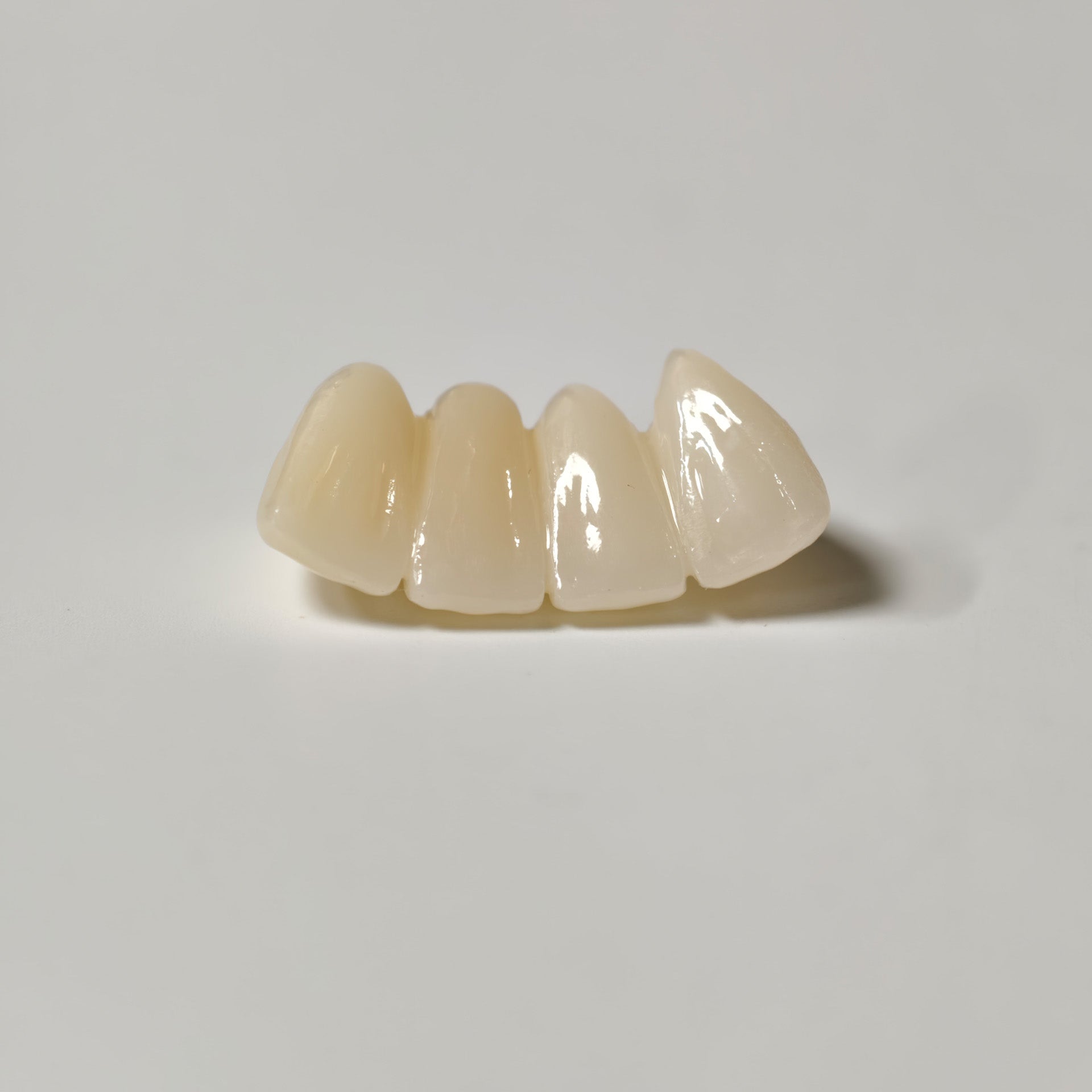 High - Strength Zirconia Bridge
