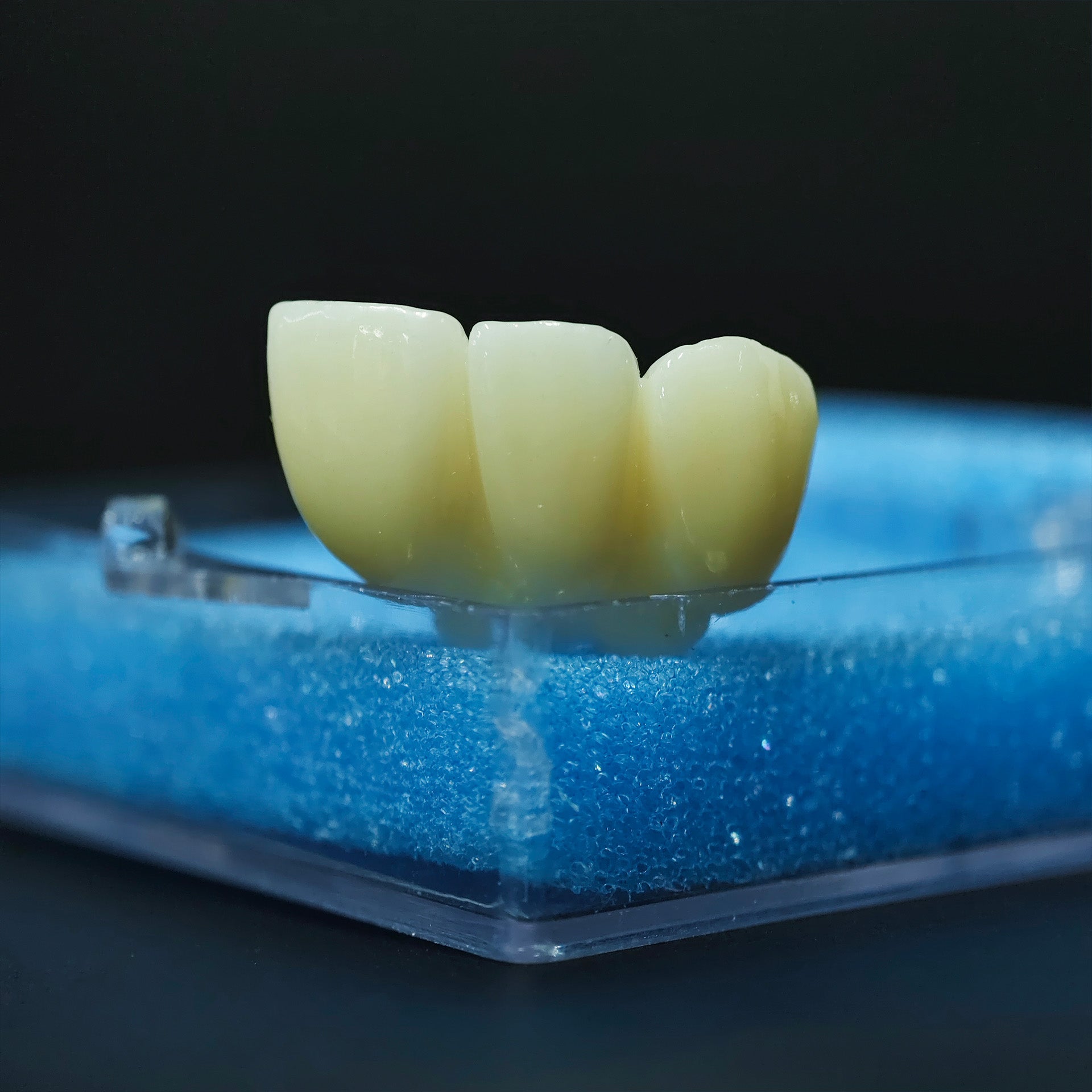 High - Strength Zirconia Bridge