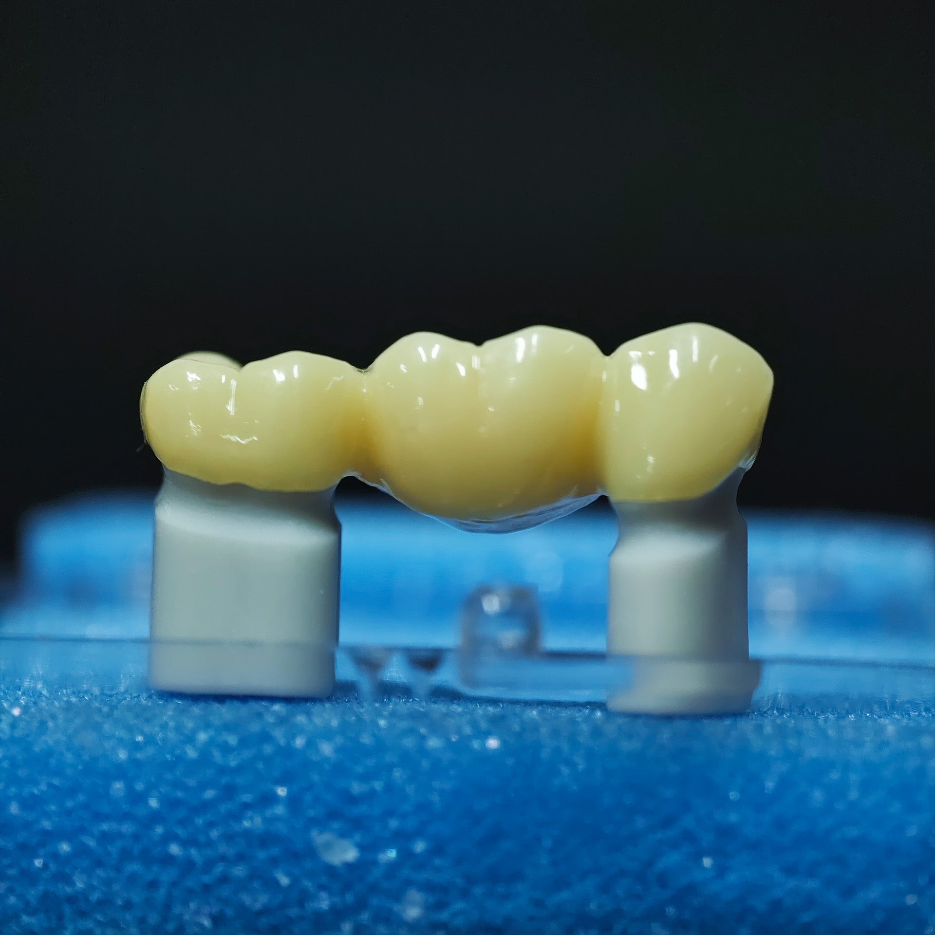 High - Strength Zirconia Bridge