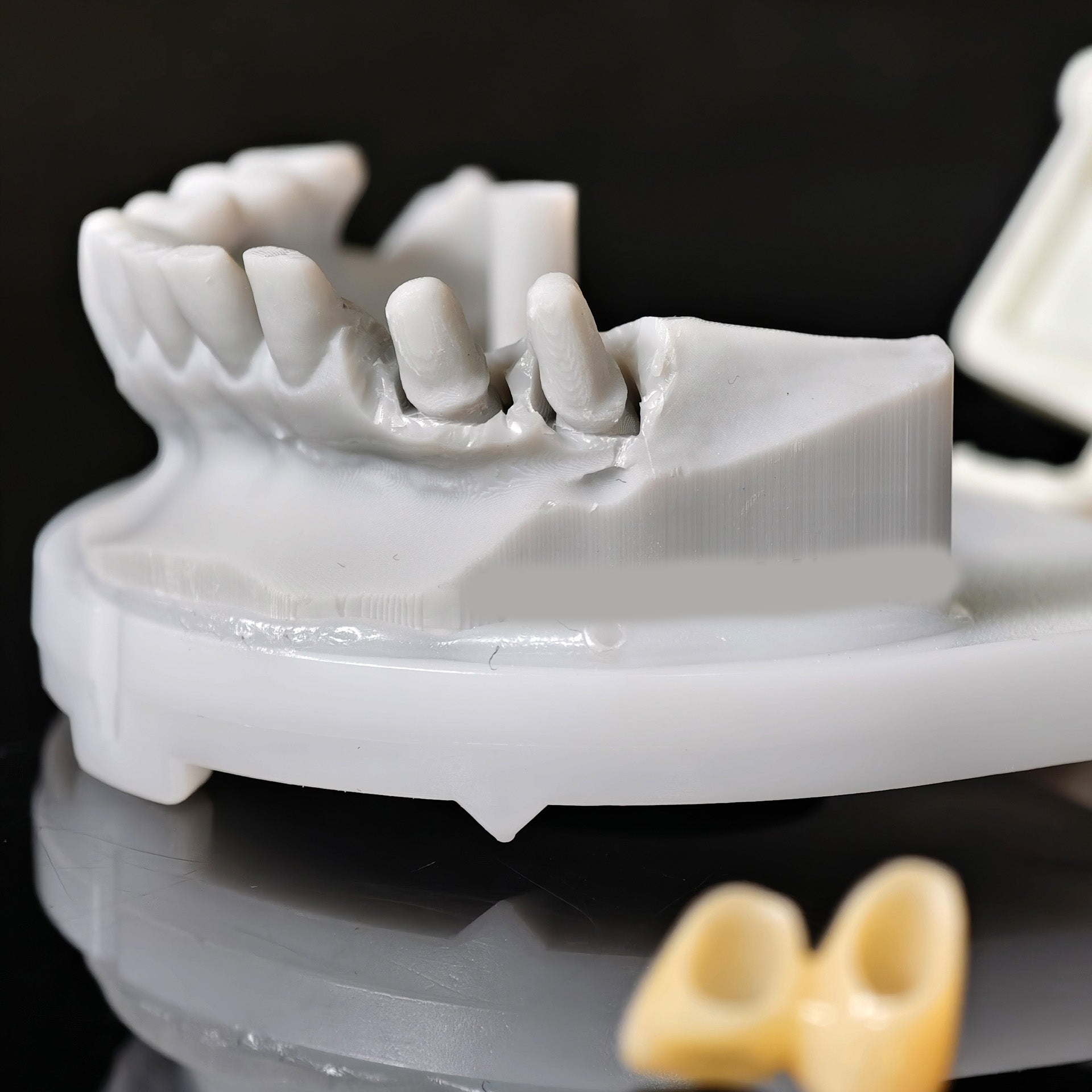 High - Strength Zirconia Bridge