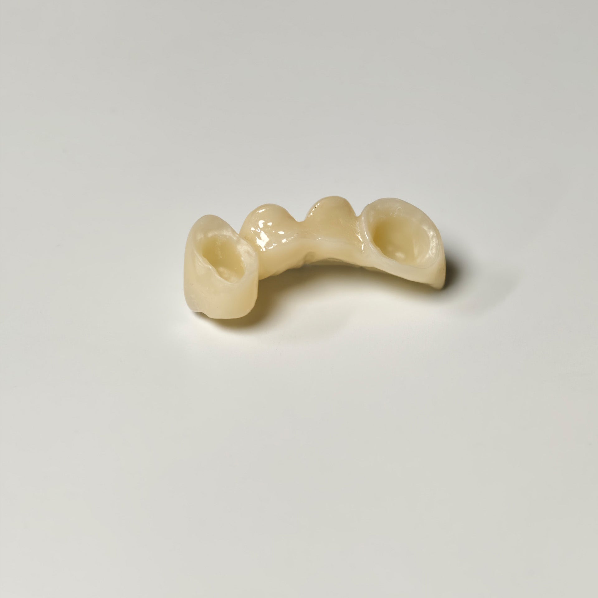 High - Strength Zirconia Bridge