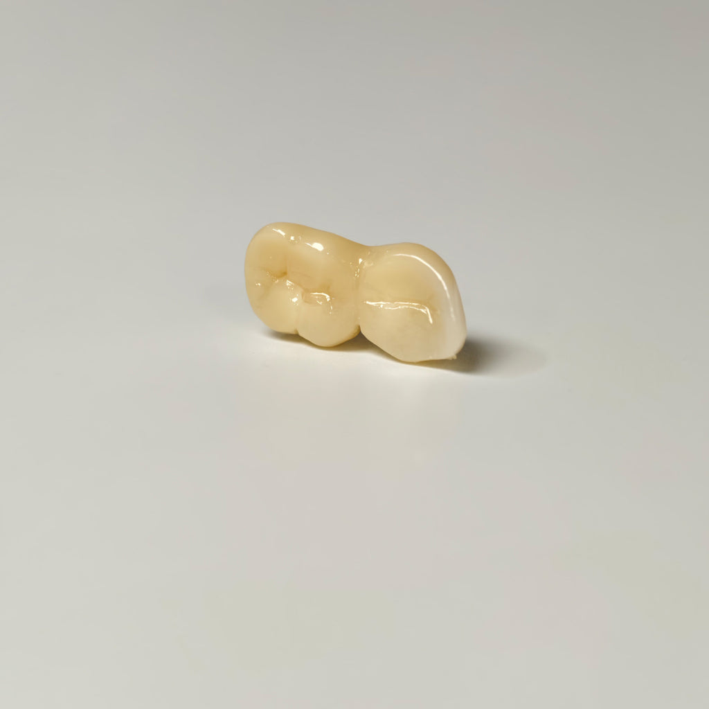 High - Strength Zirconia Bridge