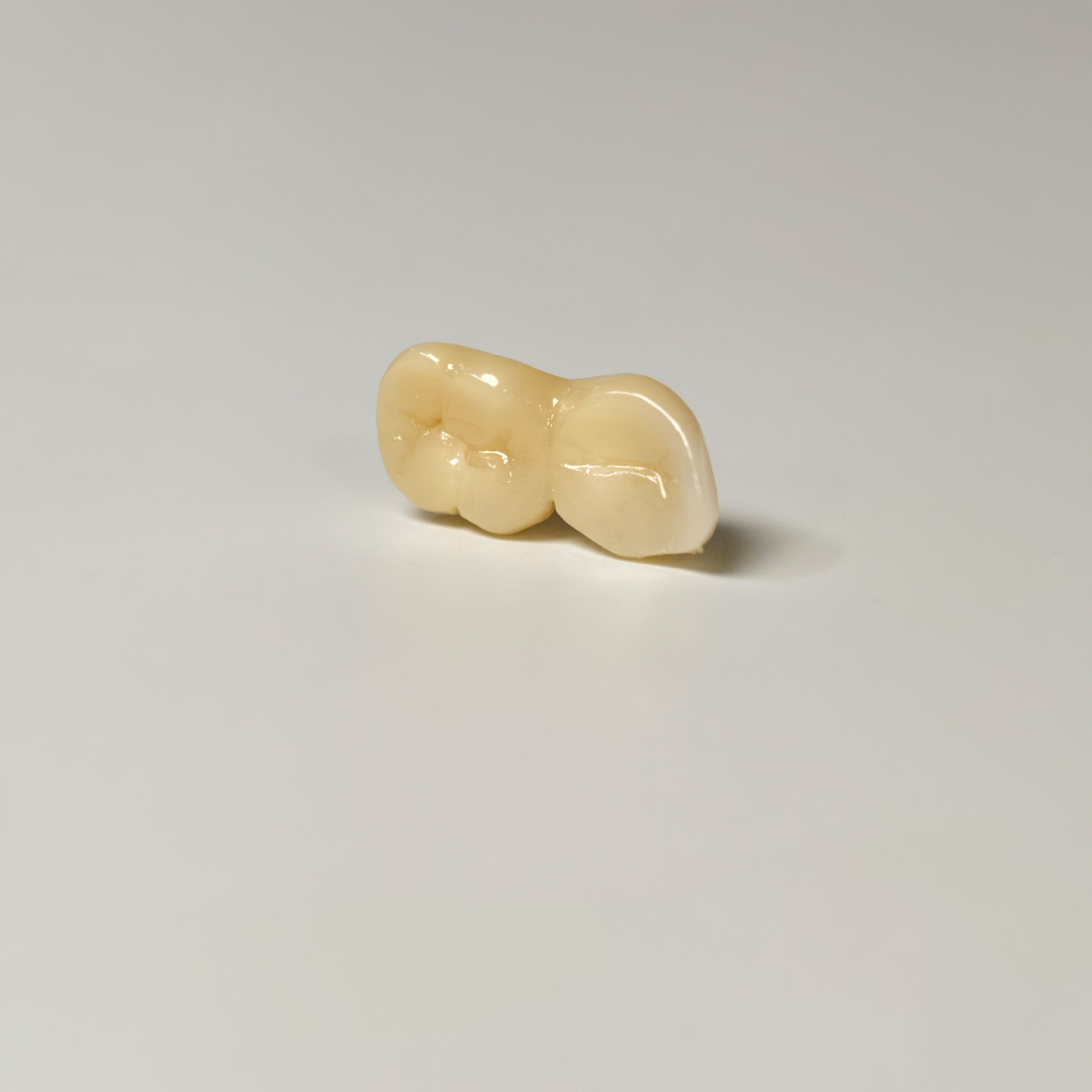 High - Strength Zirconia Bridge