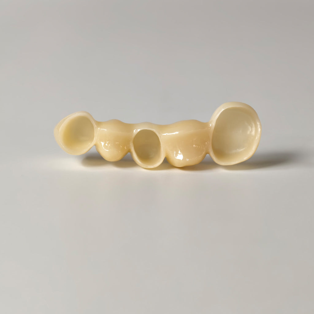 High - Strength Zirconia Bridge