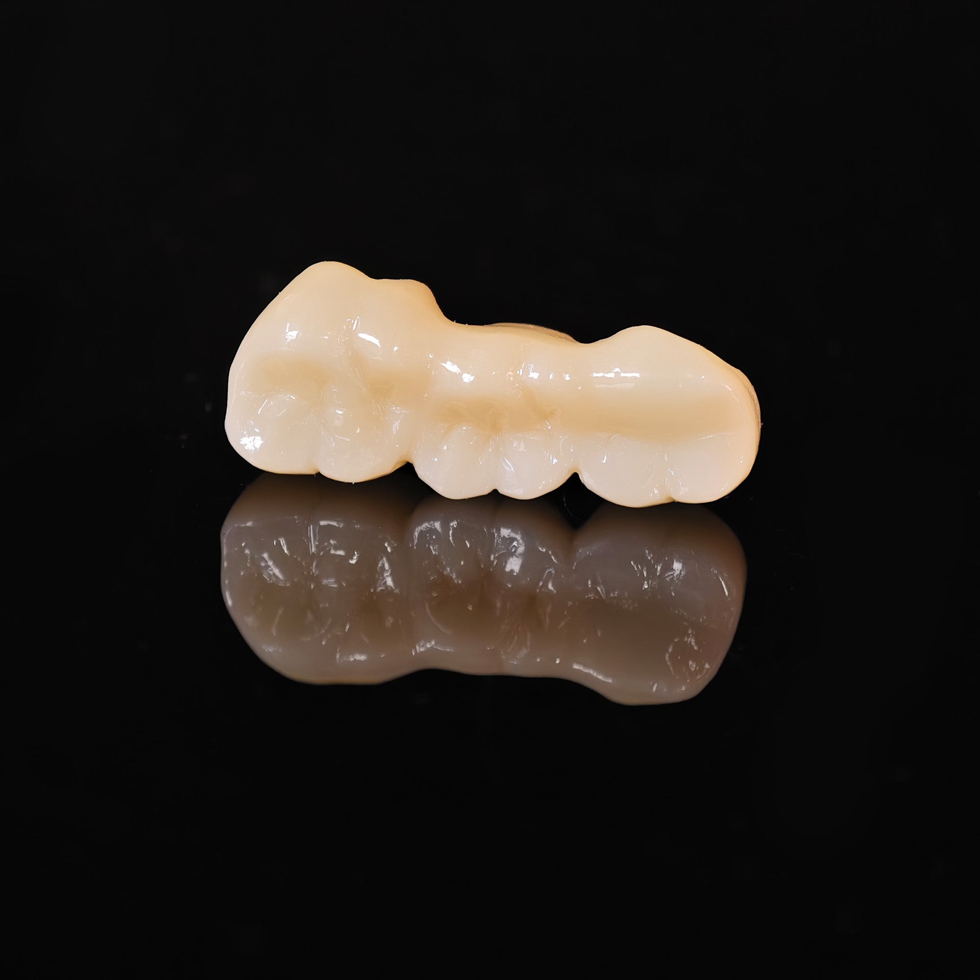 High - Strength Zirconia Bridge