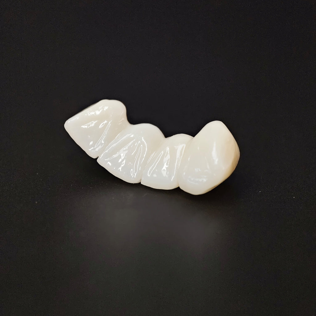 High - Strength Zirconia Bridge