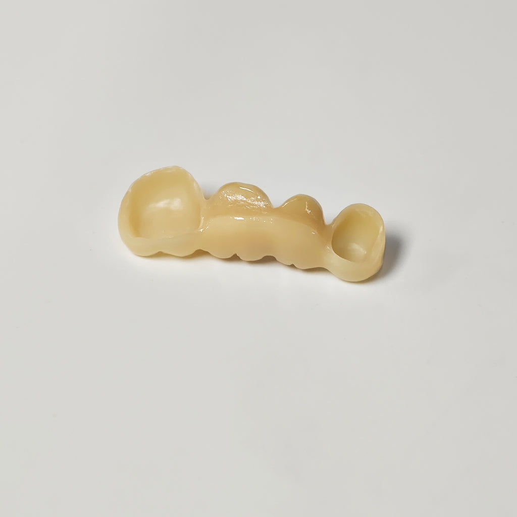 High - Strength Zirconia Bridge