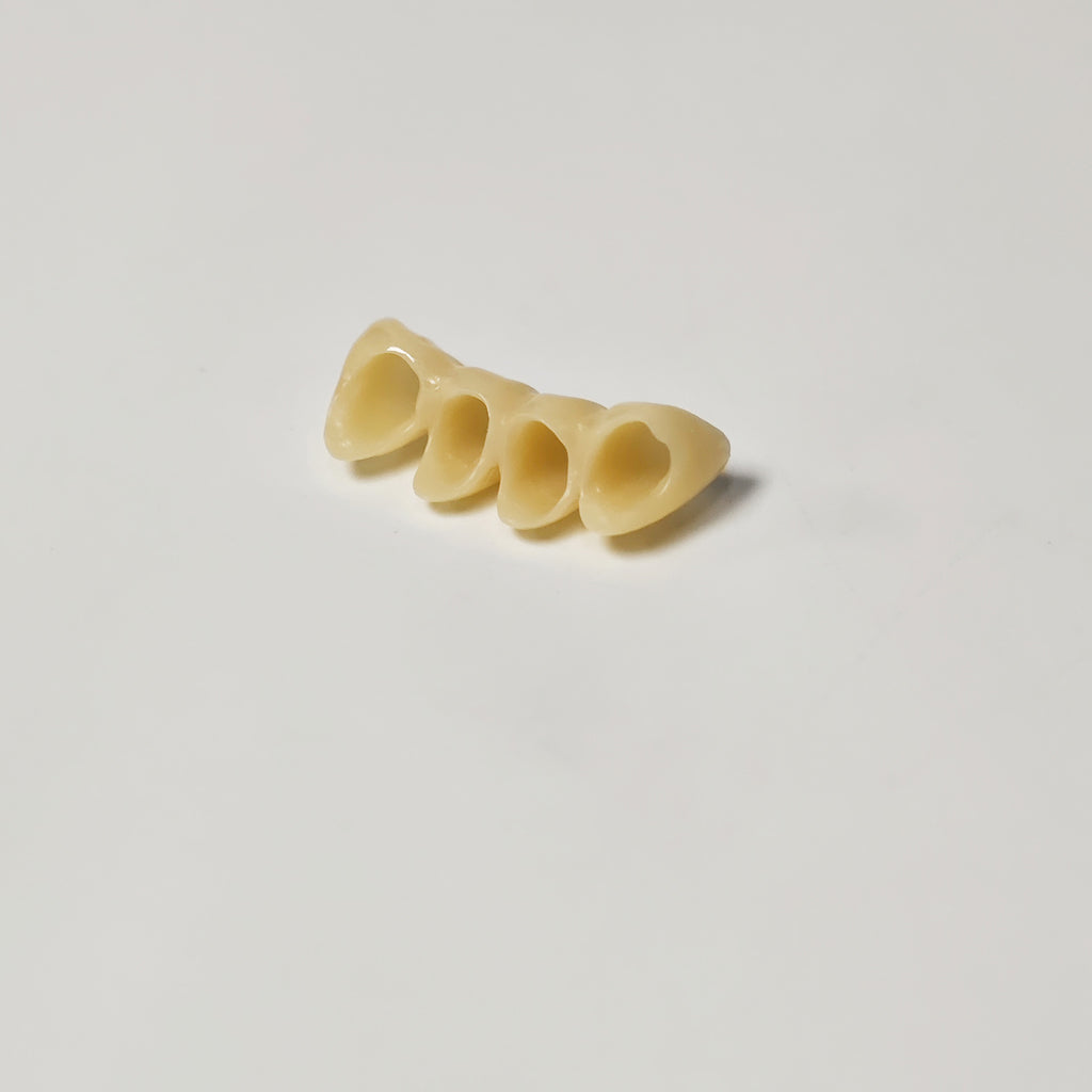 High - Strength Zirconia Bridge