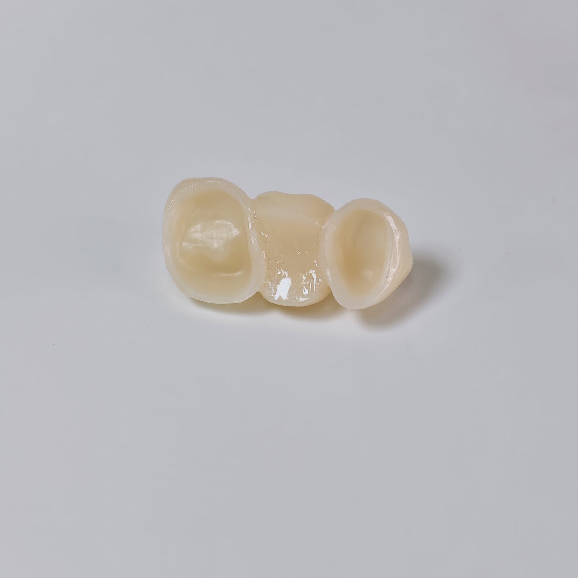 High - Strength Zirconia Bridge