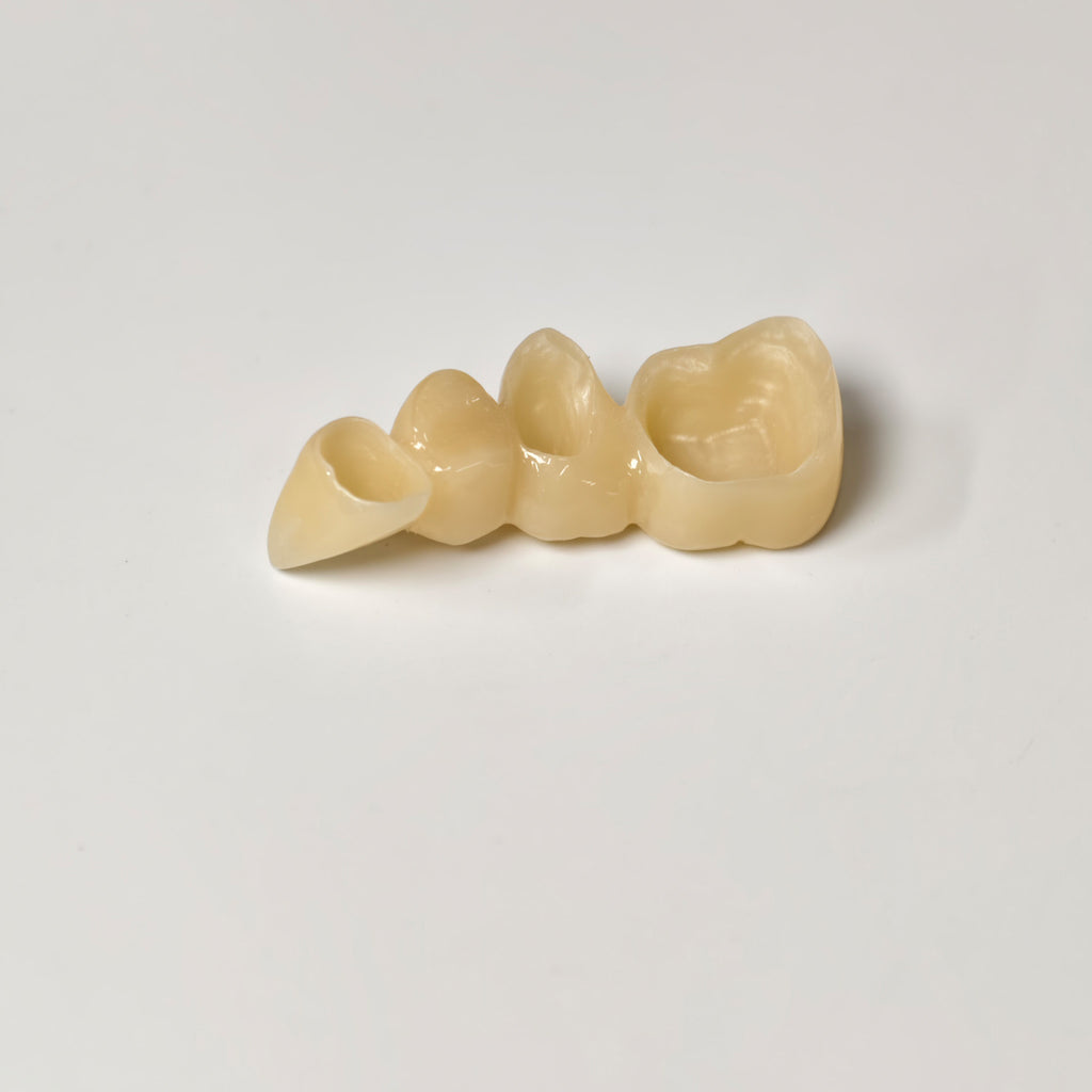 High - Strength Zirconia Bridge