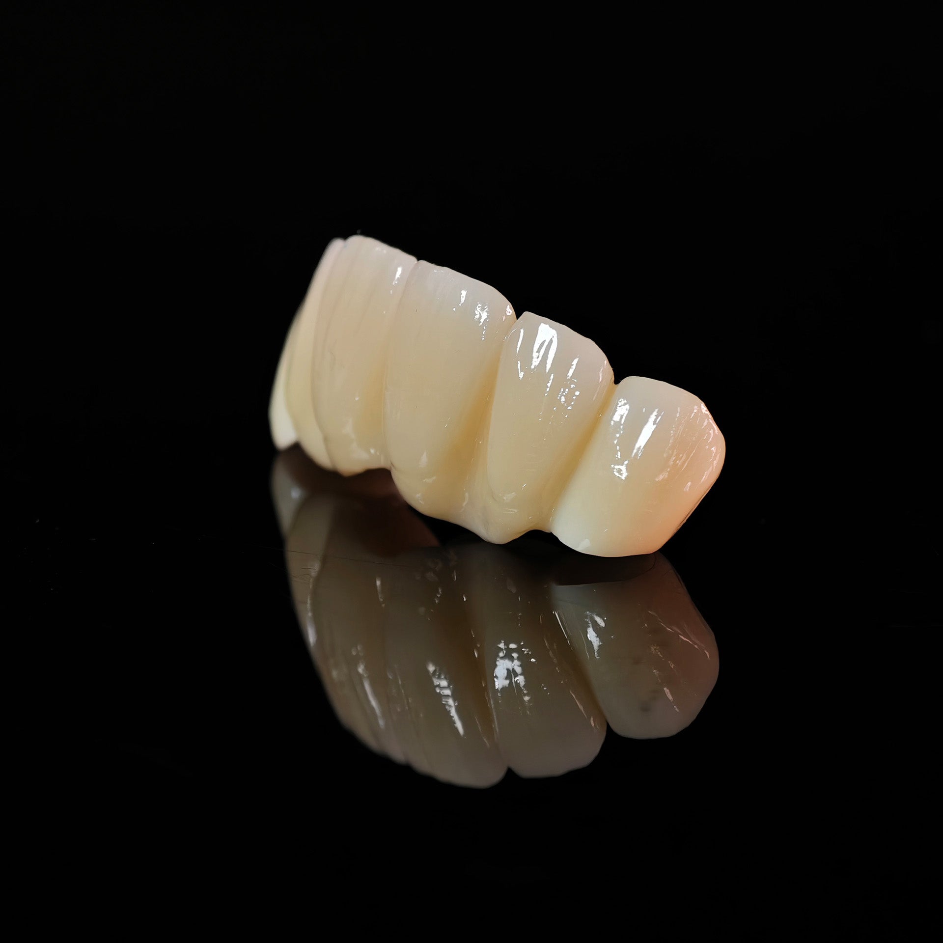 High - Strength Zirconia Bridge
