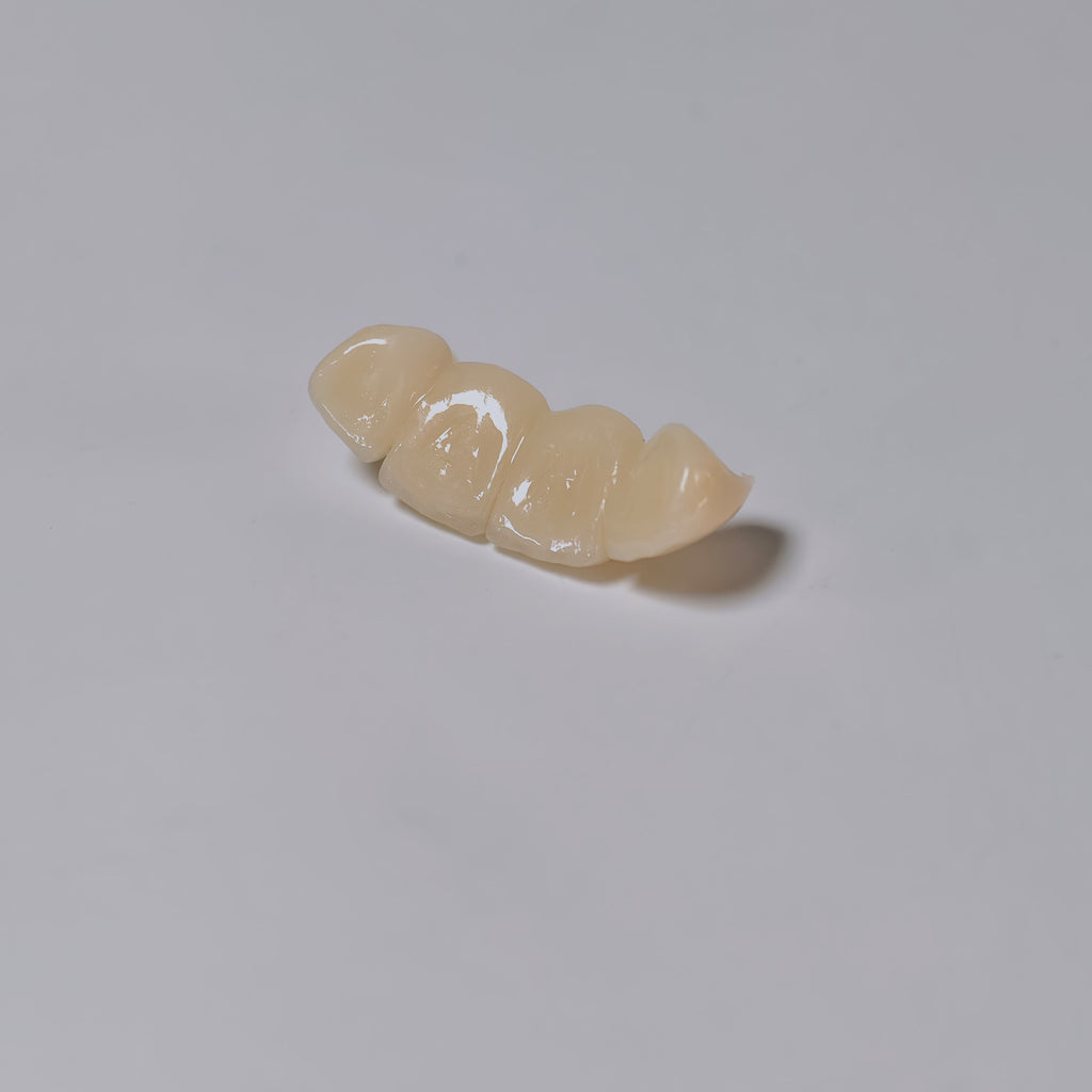 High - Strength Zirconia Bridge