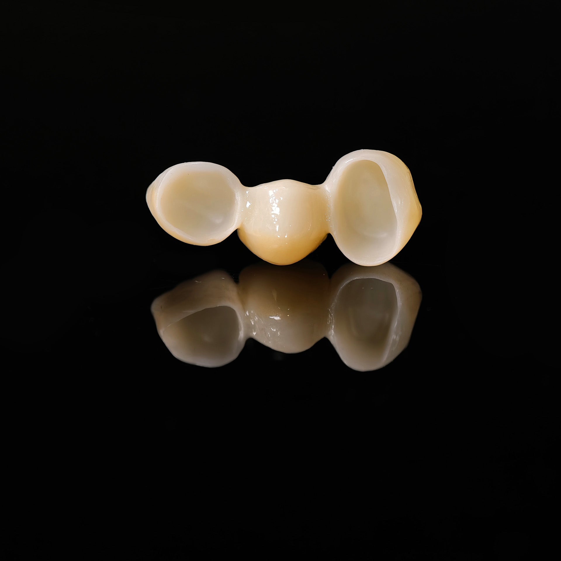 High - Strength Zirconia Bridge