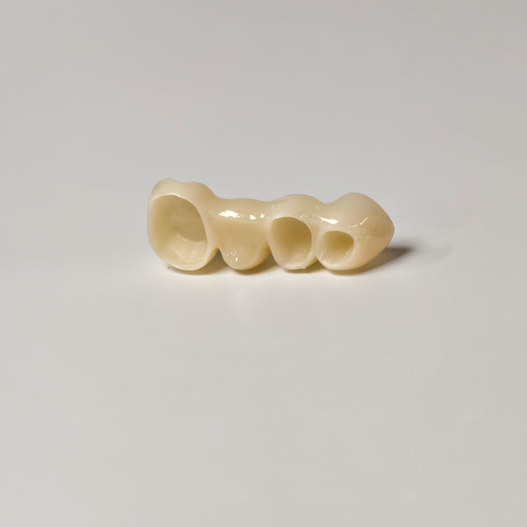 High - Strength Zirconia Bridge
