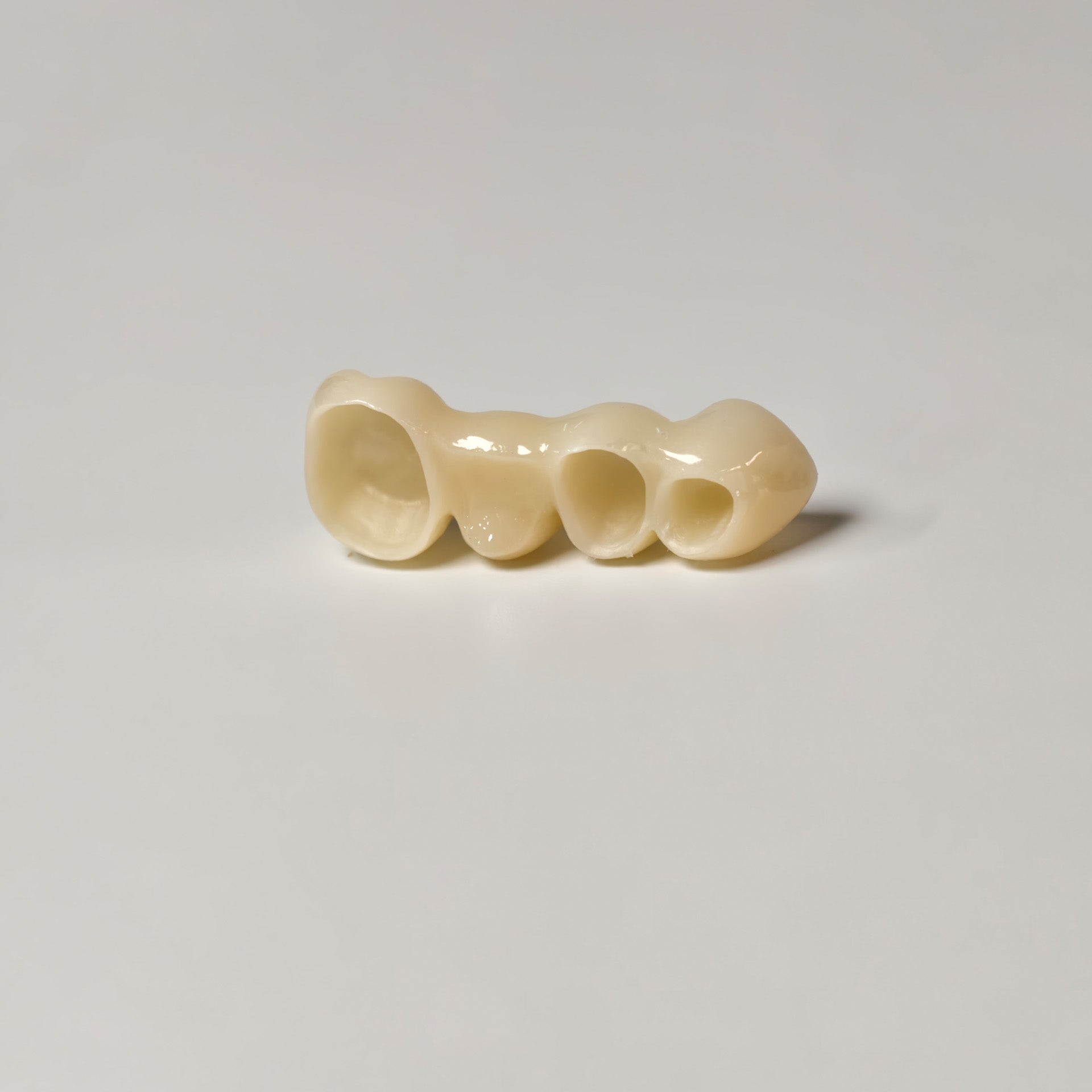 High - Strength Zirconia Bridge