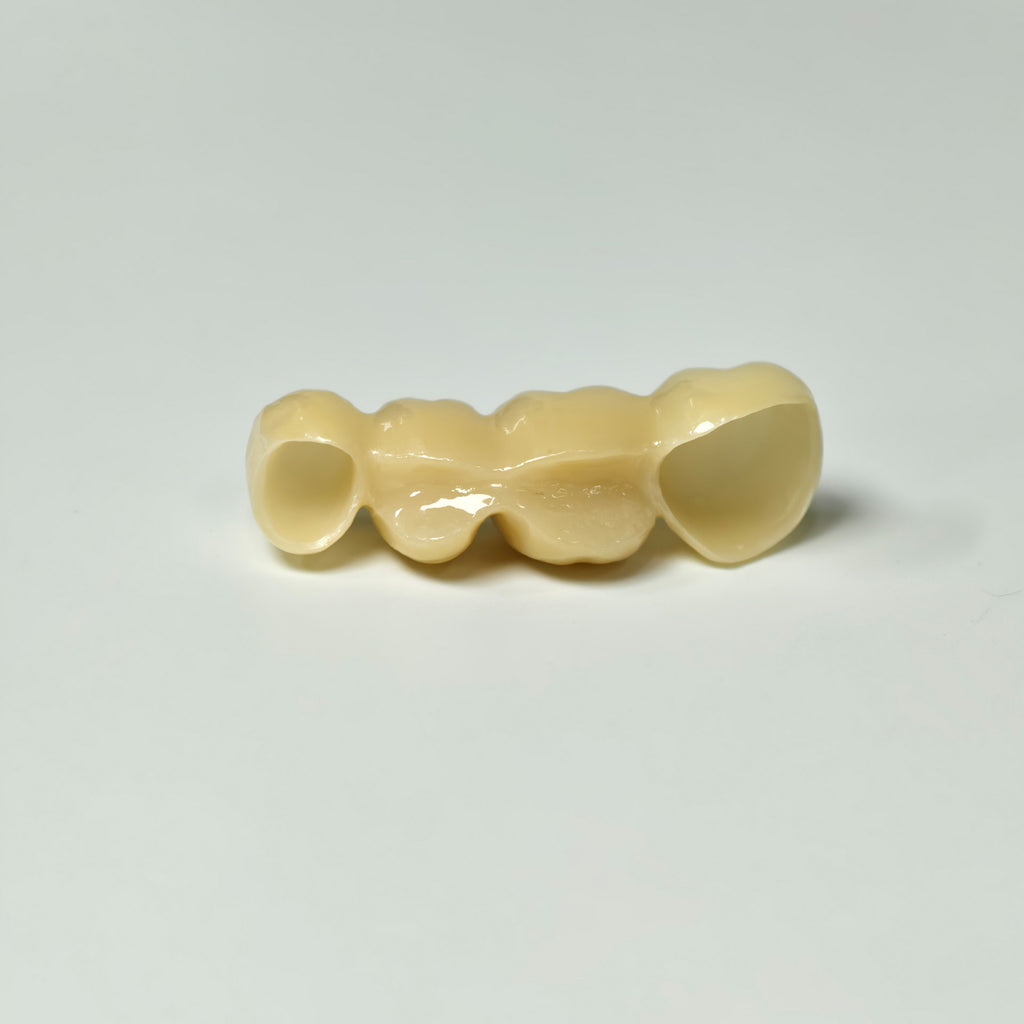 High - Strength Zirconia Bridge