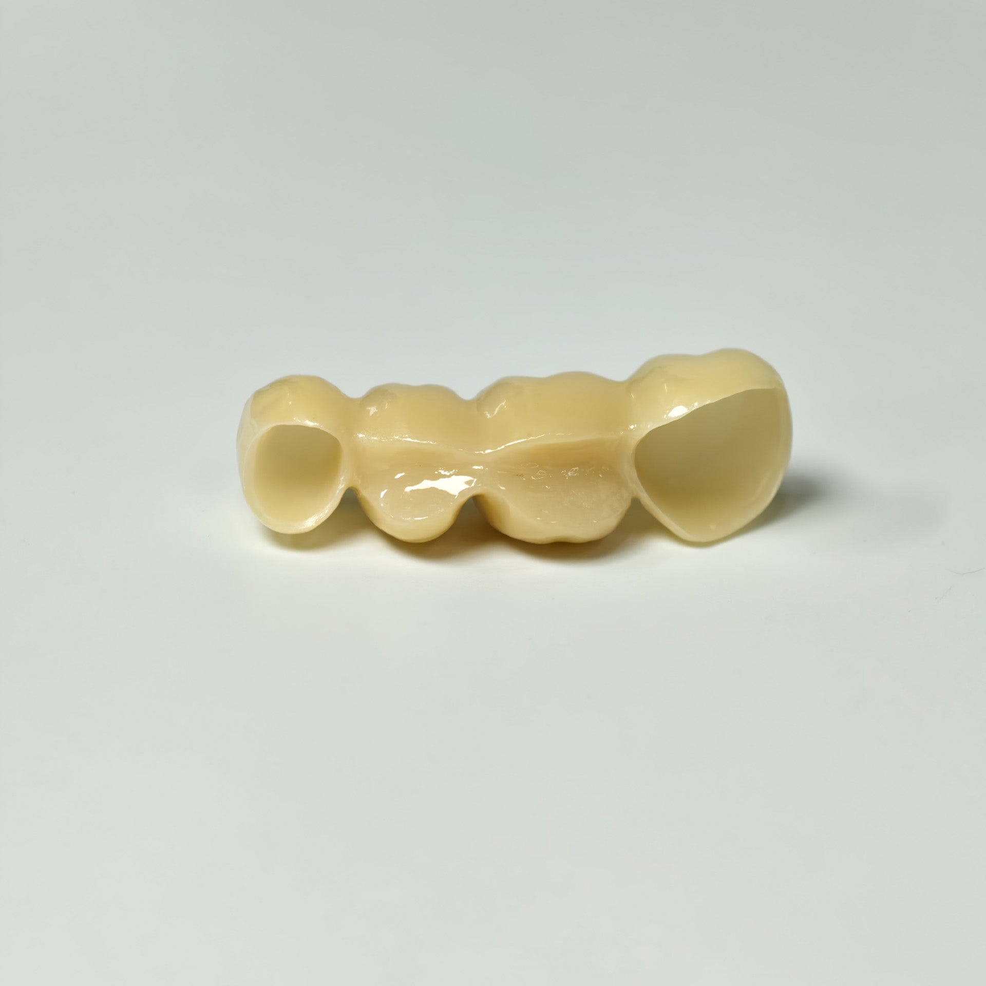 High - Strength Zirconia Bridge