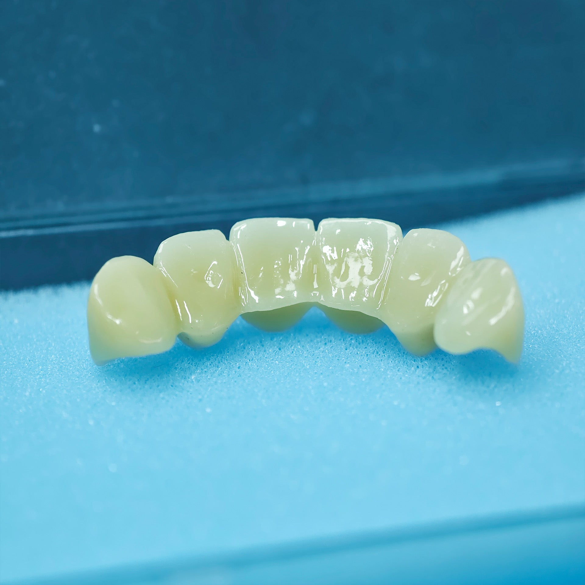 High - Strength Zirconia Bridge