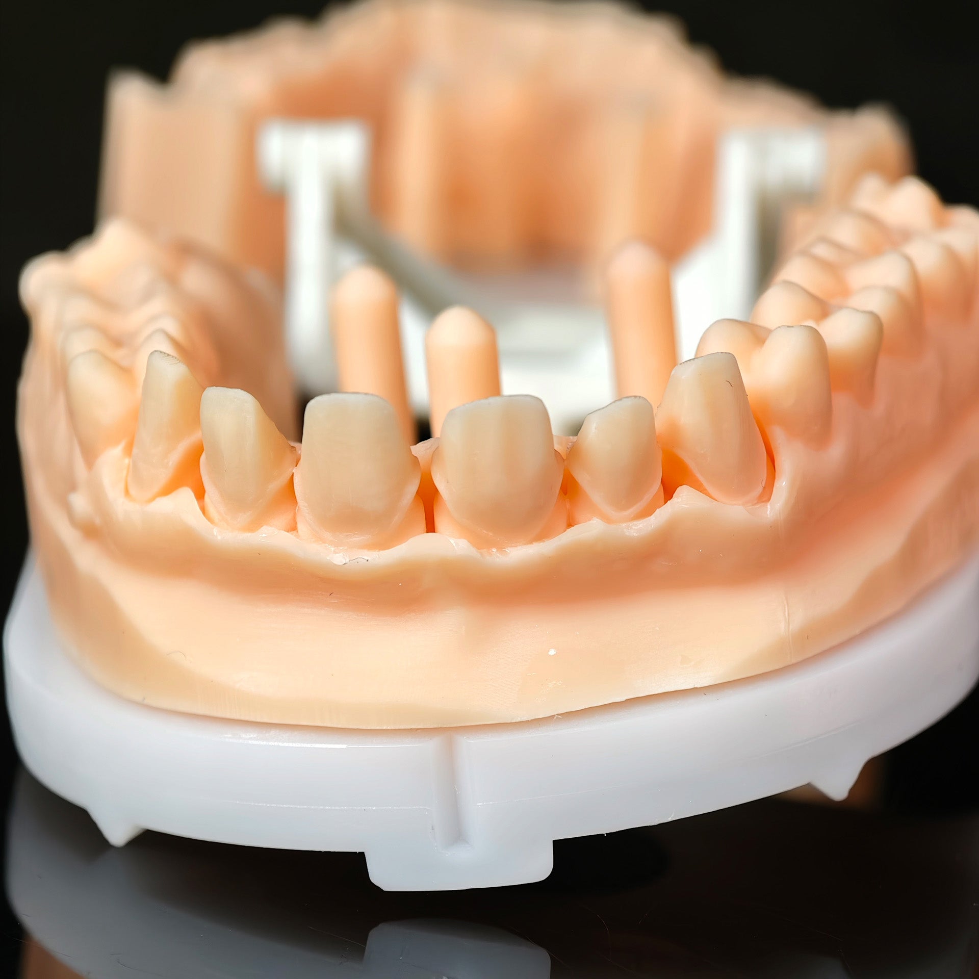 High - Strength Zirconia Crowns