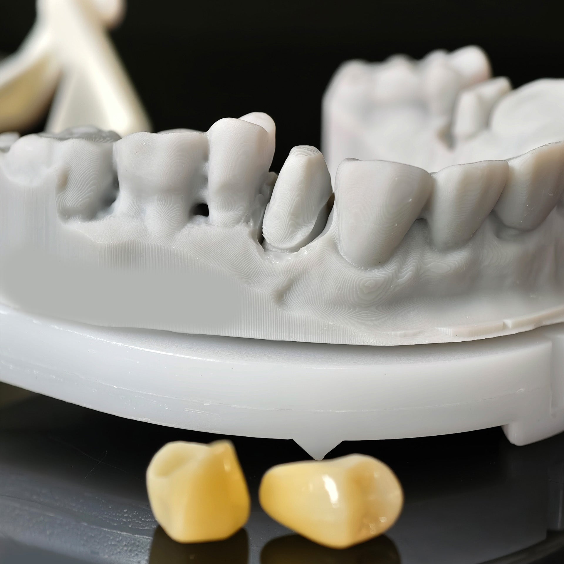 High - Strength Zirconia Crowns