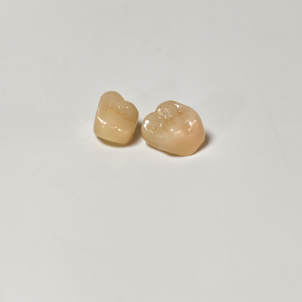 High - Strength Zirconia Crowns