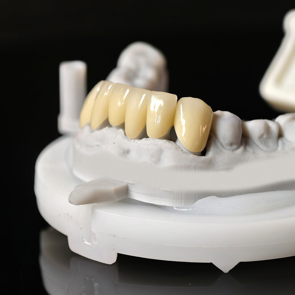 High - Strength Zirconia Crowns