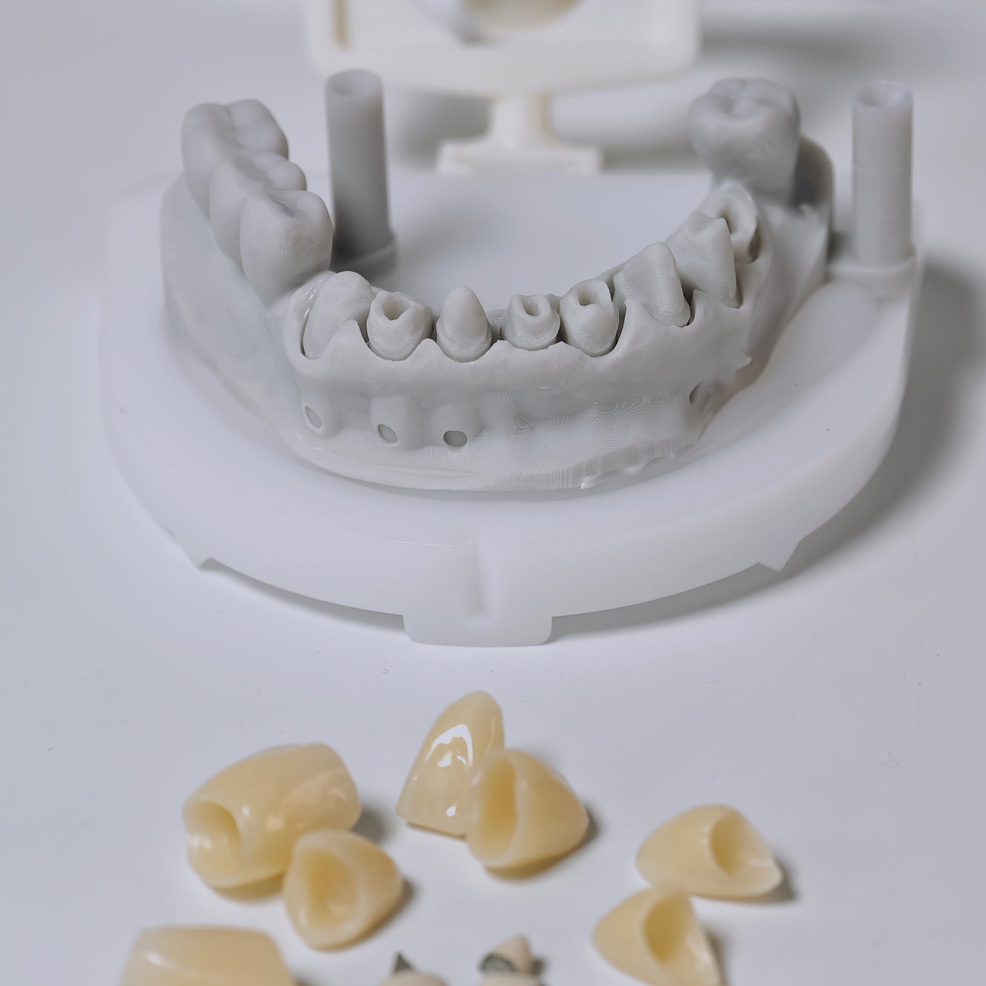 High - Strength Zirconia Crown with Post and core