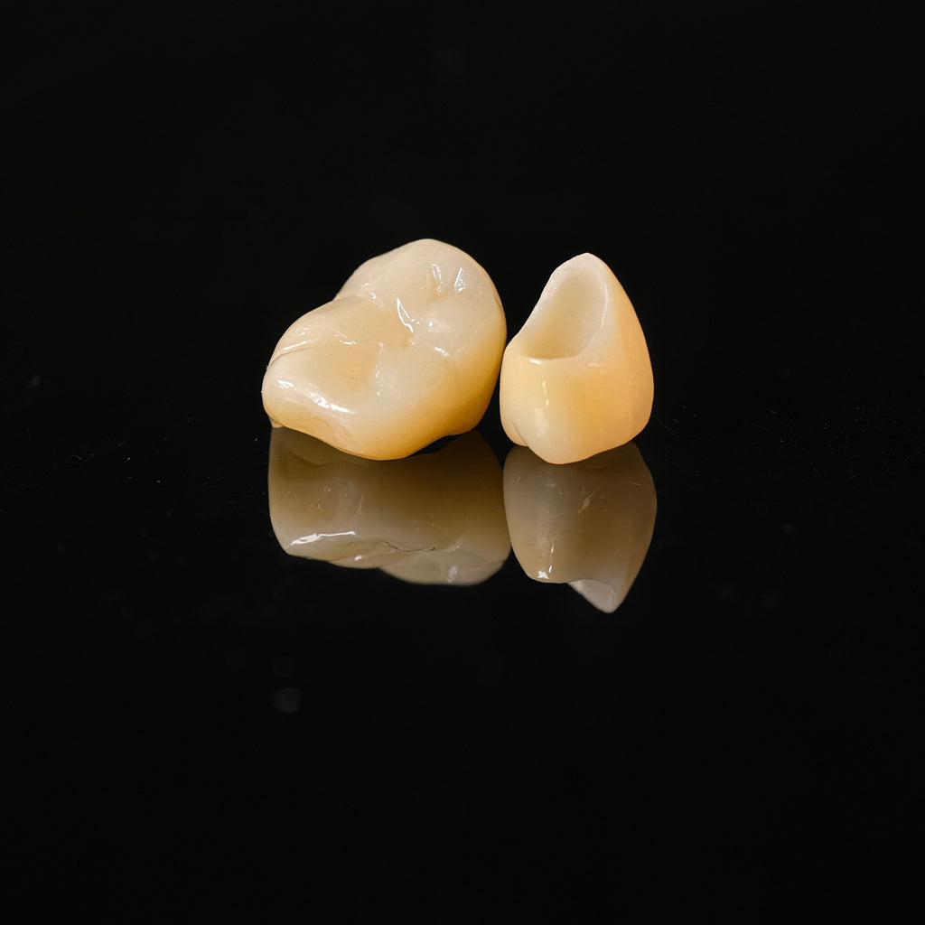 High - Strength Zirconia Dental Crowns