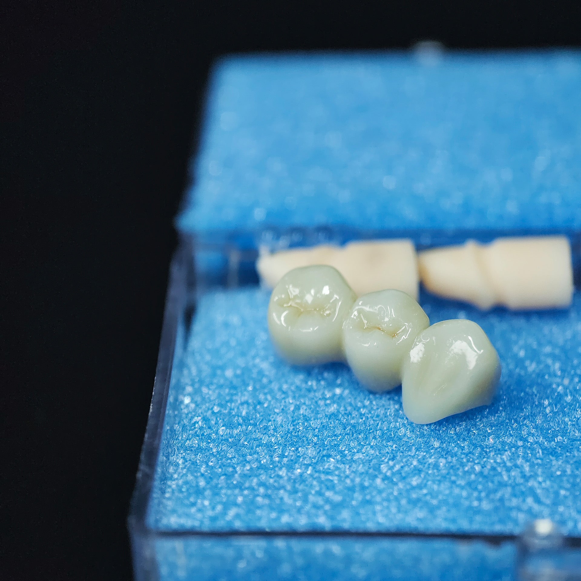 High - Strength Zirconia Bridge