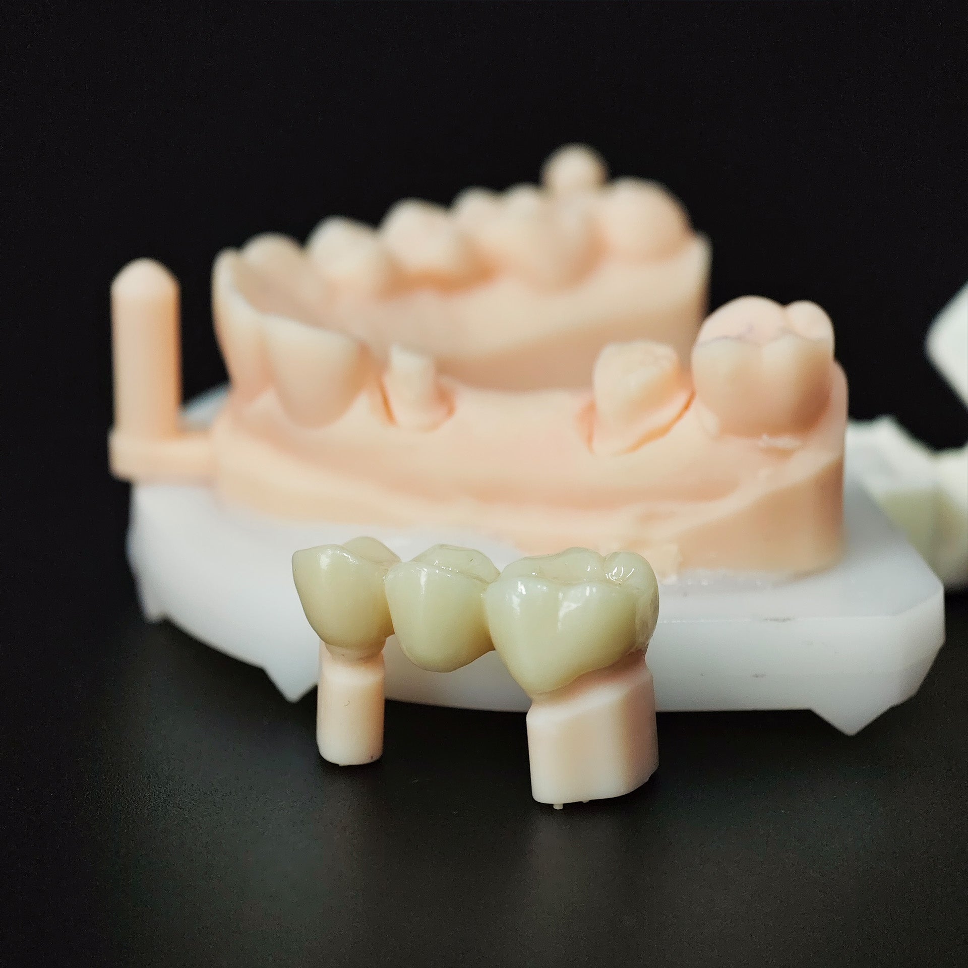 High - Strength Zirconia Bridge