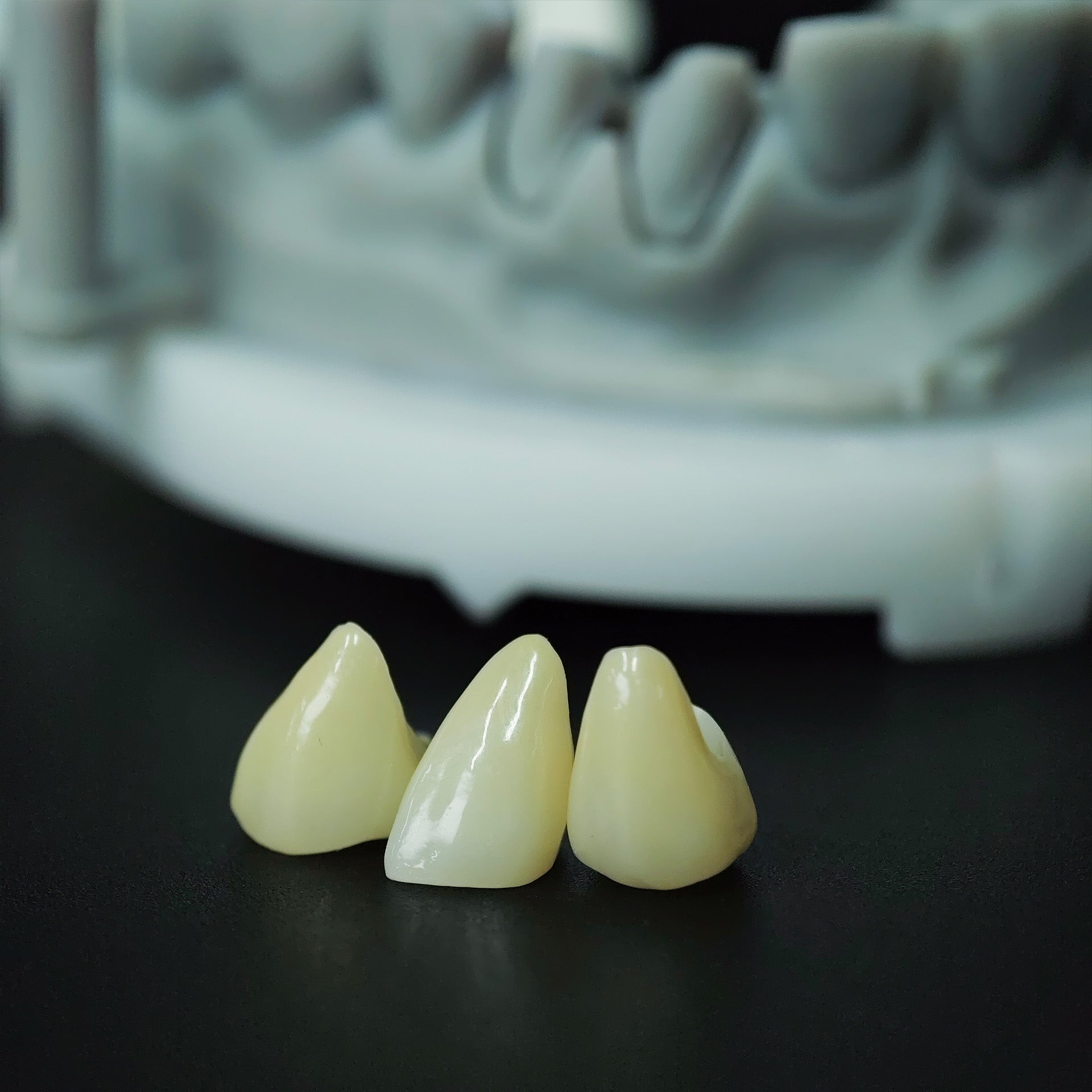High - Strength Zirconia Crowns